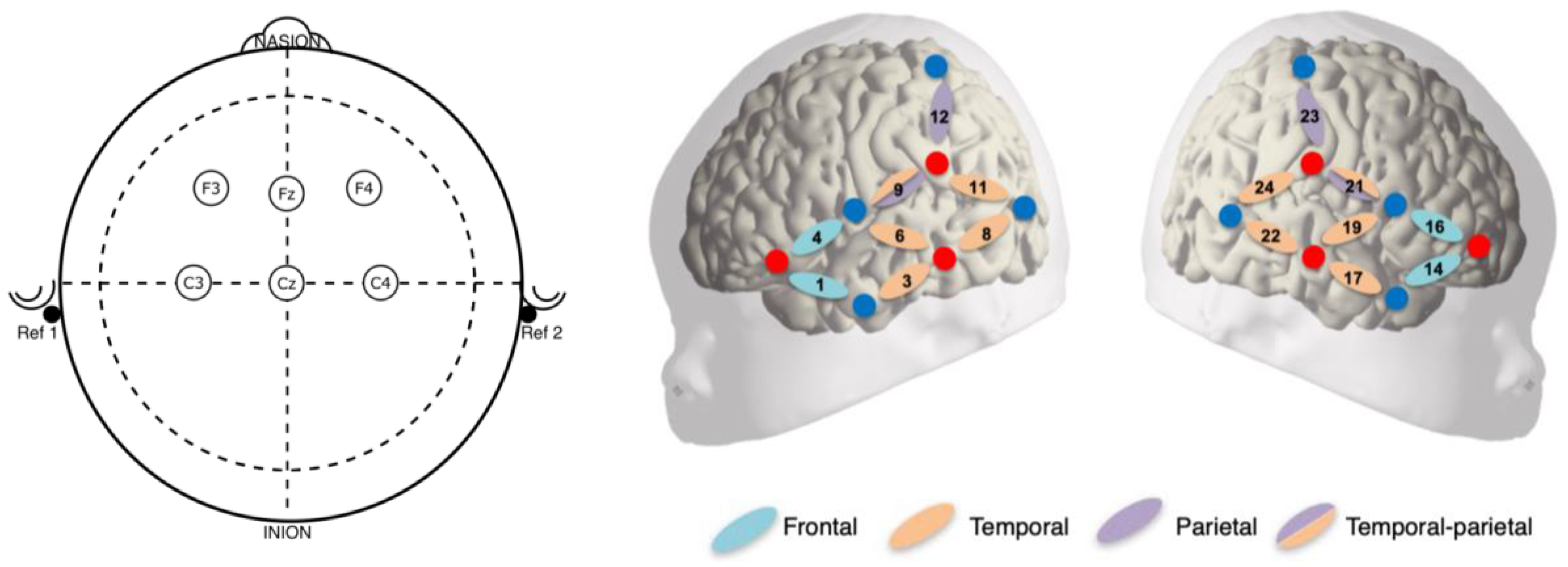 Sensors 24 04161 g002
