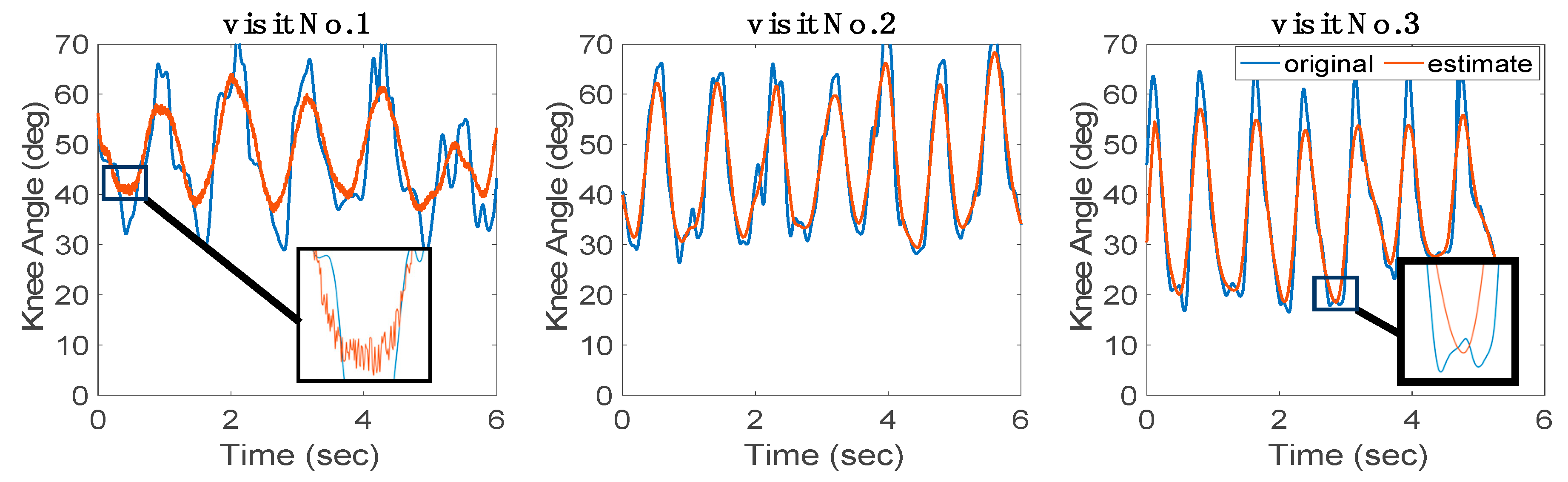 Sensors 24 04217 g011