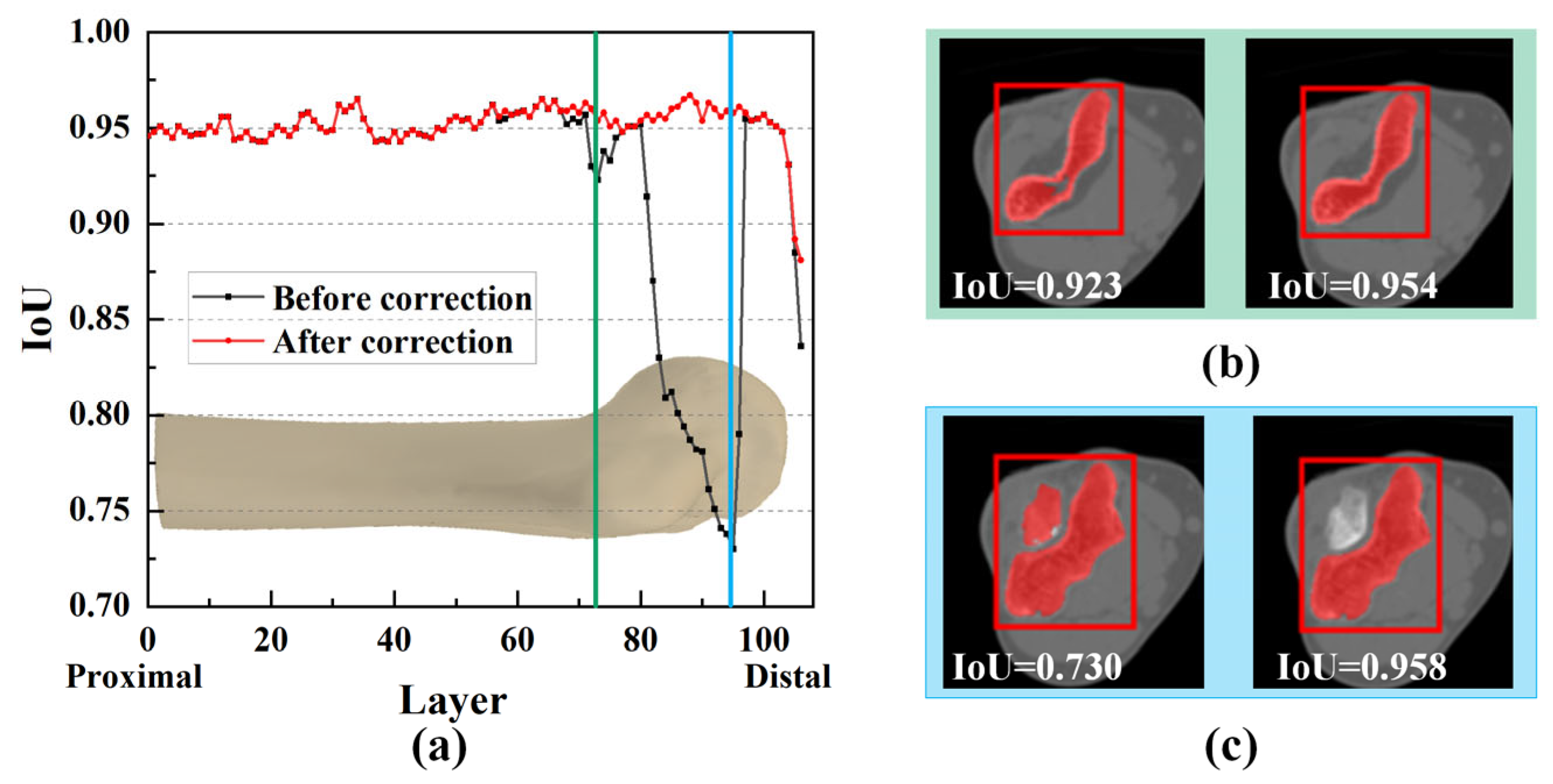 Sensors 24 04330 g011