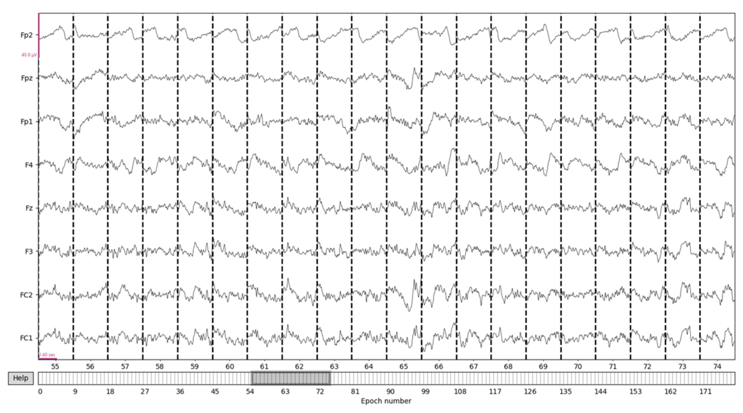 Sensors 24 04392 g007