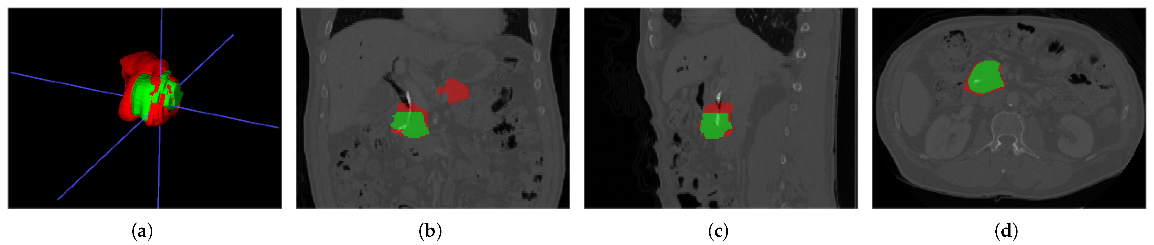 Sensors 24 04749 g003