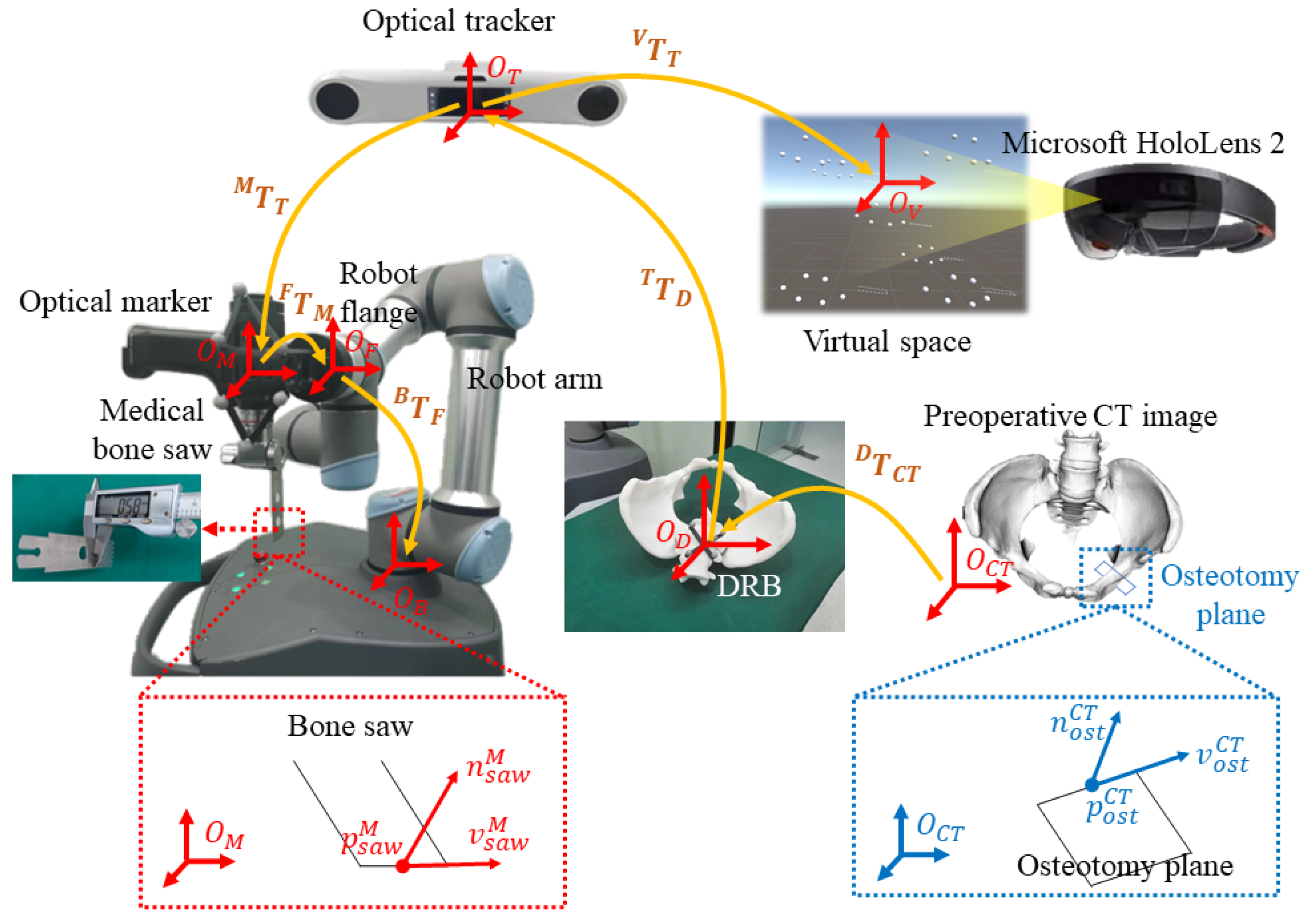 Robot-Assisted Augmented Reality (AR)-Guided Surgical