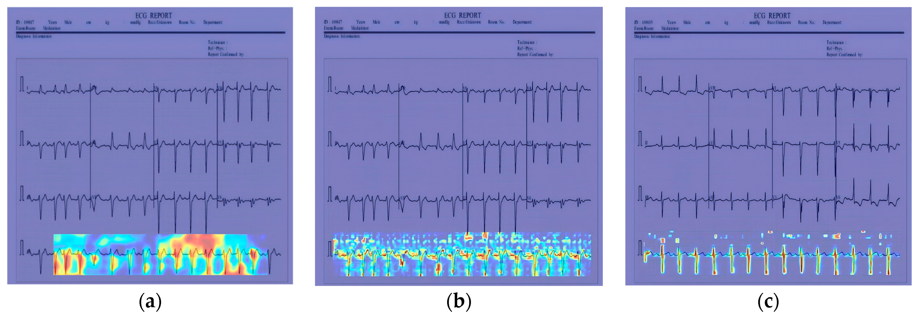 Sensors 24 05087 g014