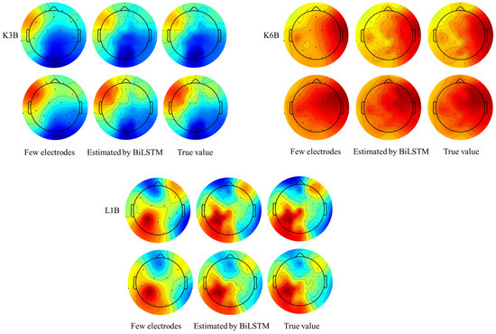A Method for the Spatial Interpolation of EEG Signals Based