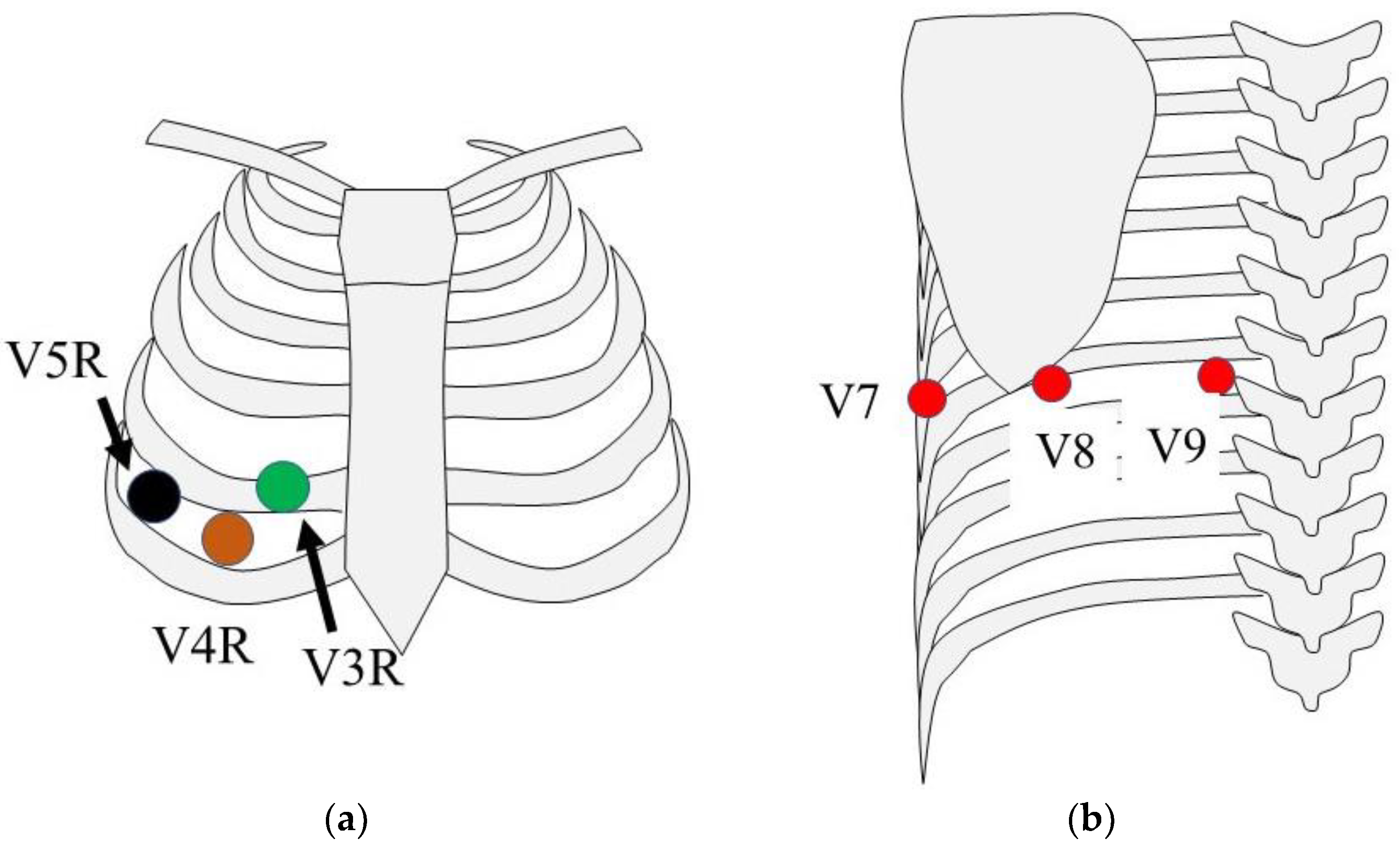 Clinical Utility Of Synthesized 18 Lead Electrocardiography