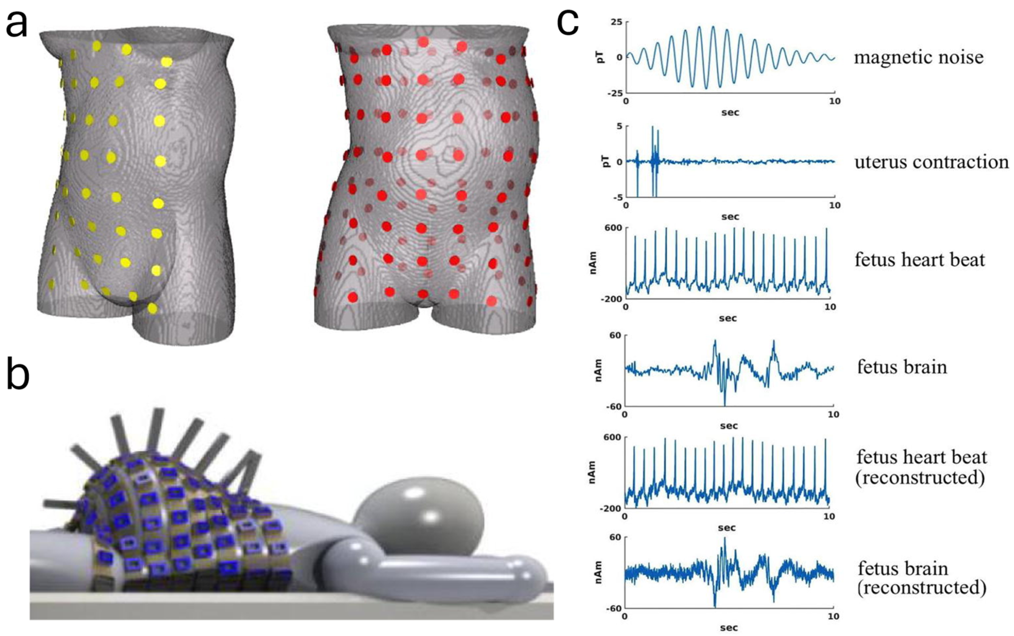Sensors 24 06426 g005