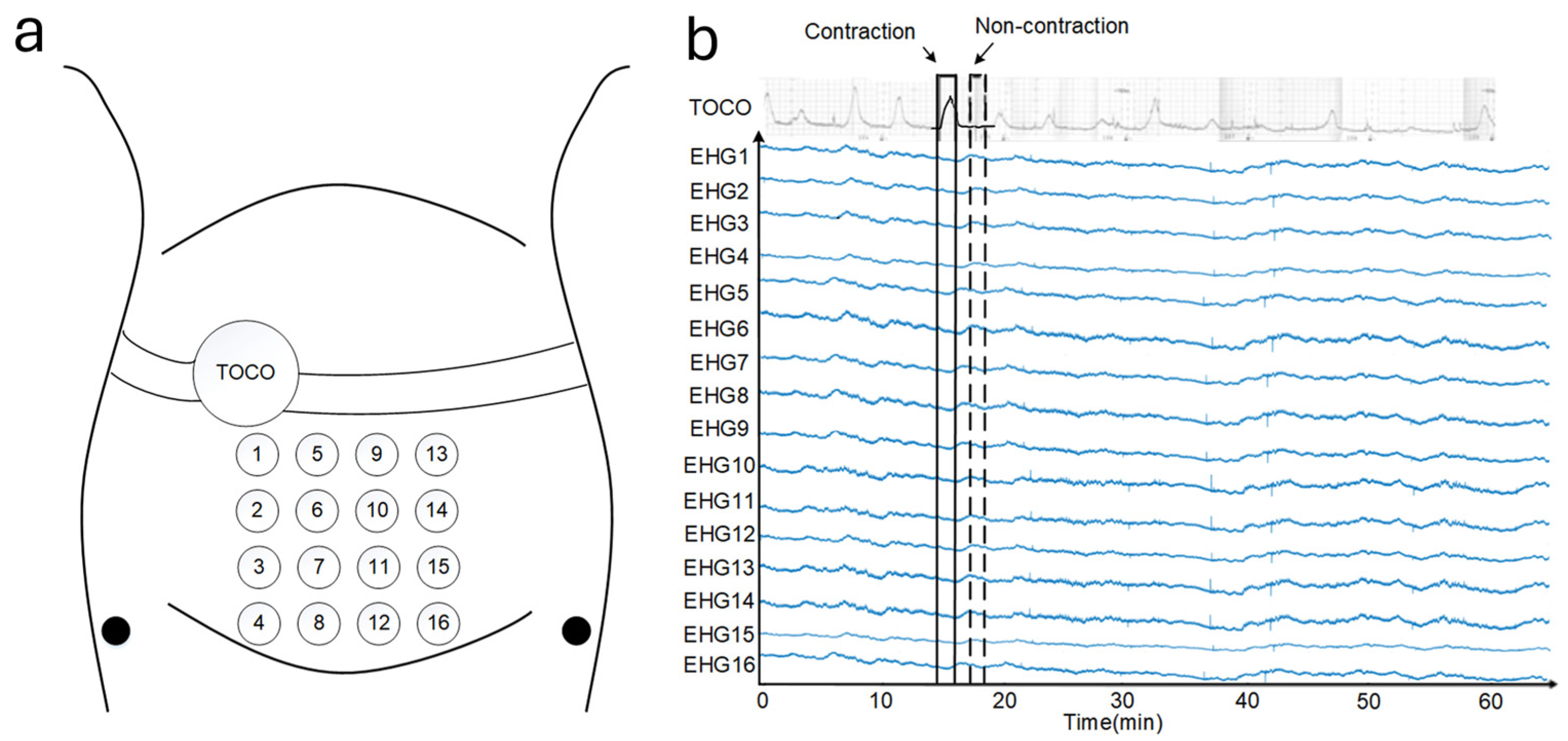 Sensors 24 06426 g006