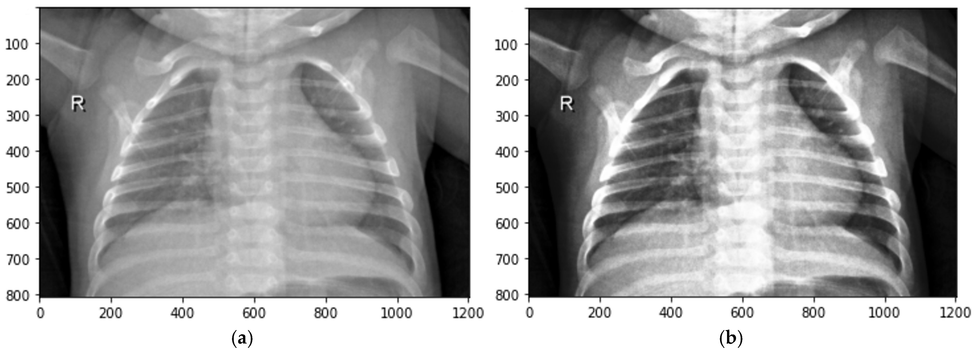 Sensors 24 06750 g005