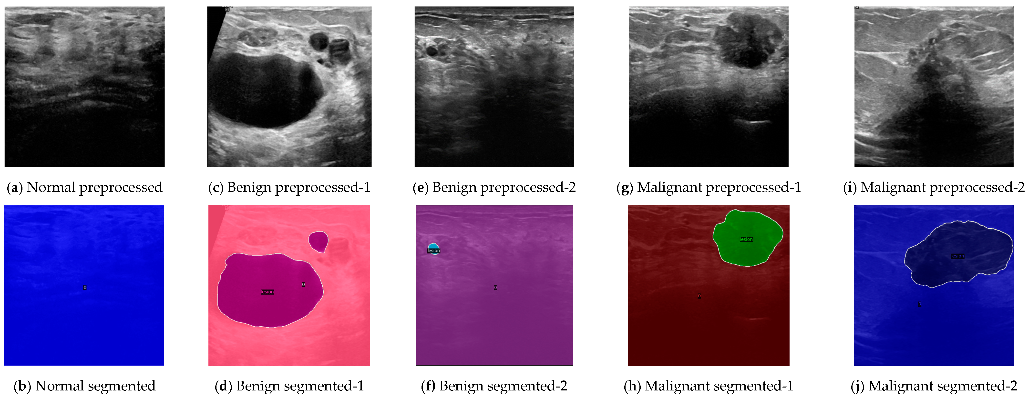 Sensors 24 06890 g003