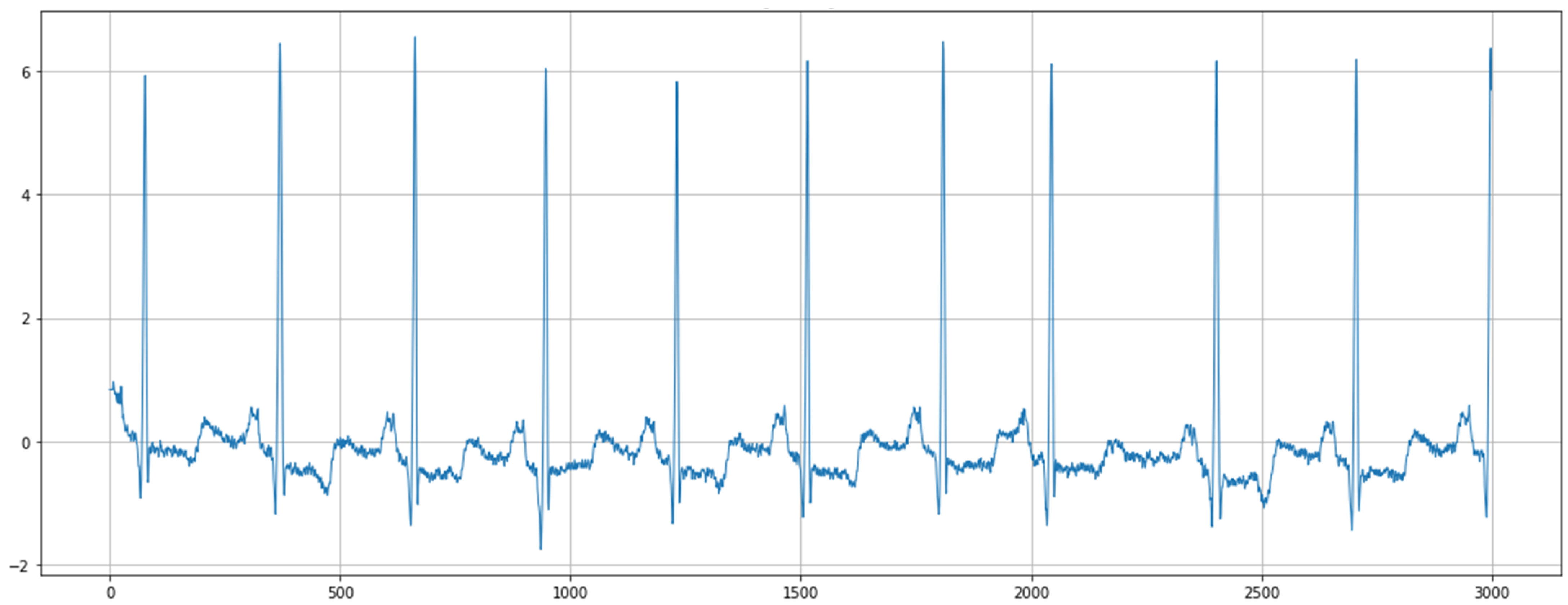 Advanced Noise-Resistant Electrocardiography Classification Using ...
