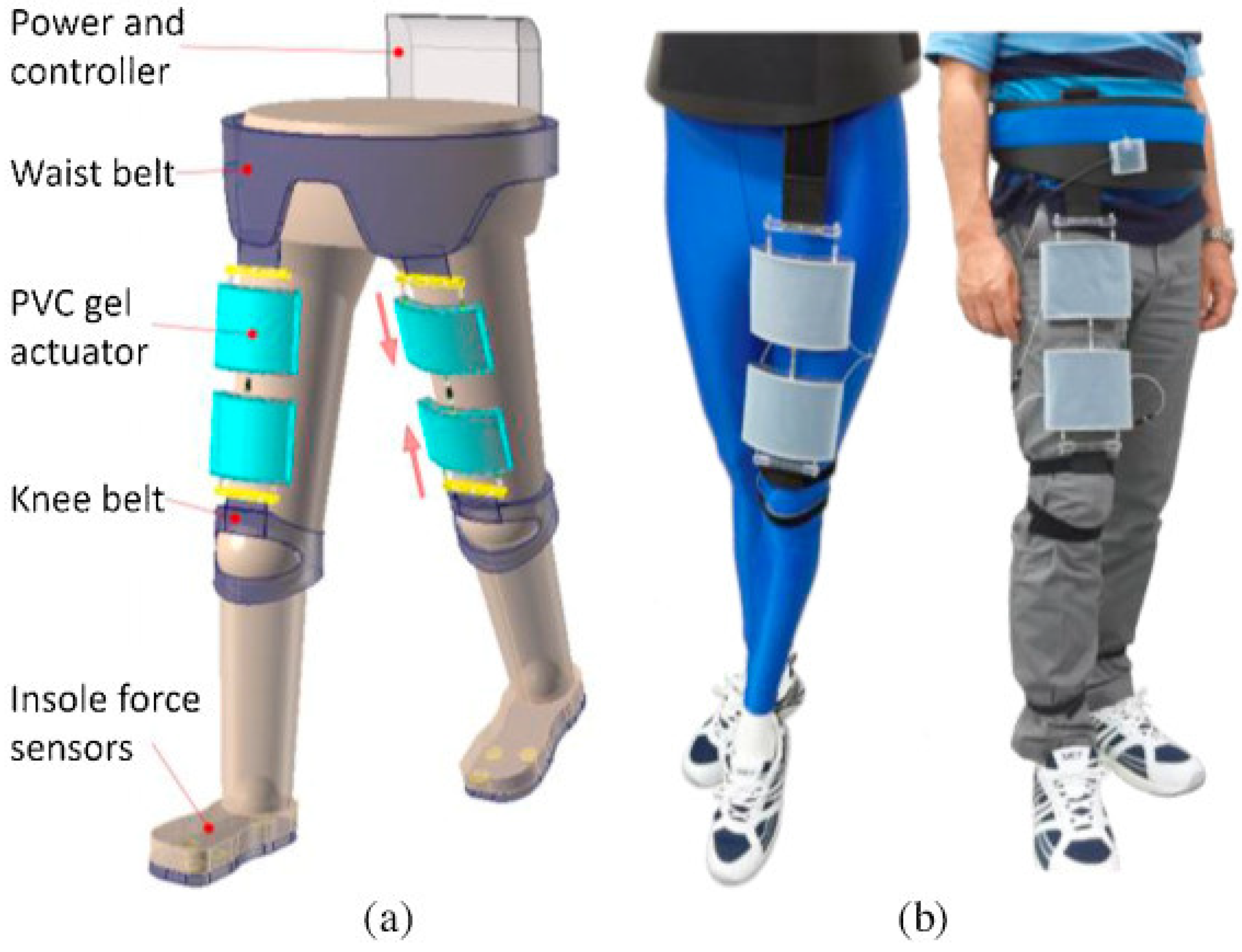 その他 Exercise - Atex Ultra Leg Amazon.com : Tib Bar Adjustable Exura-Fits Both 2 And 1-Inch