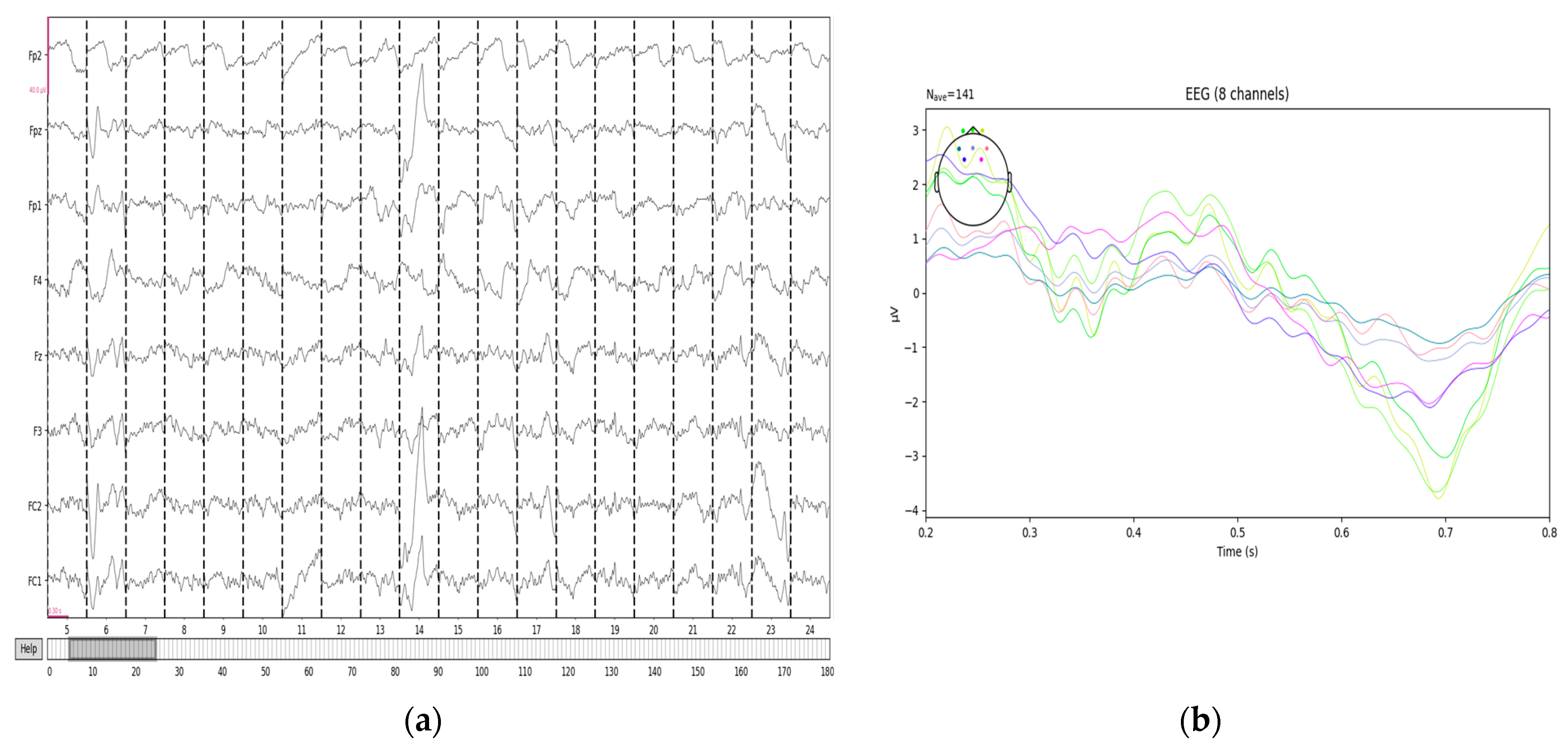 An Identification Method for Road Hypnosis Based on the Fusion of Human ...