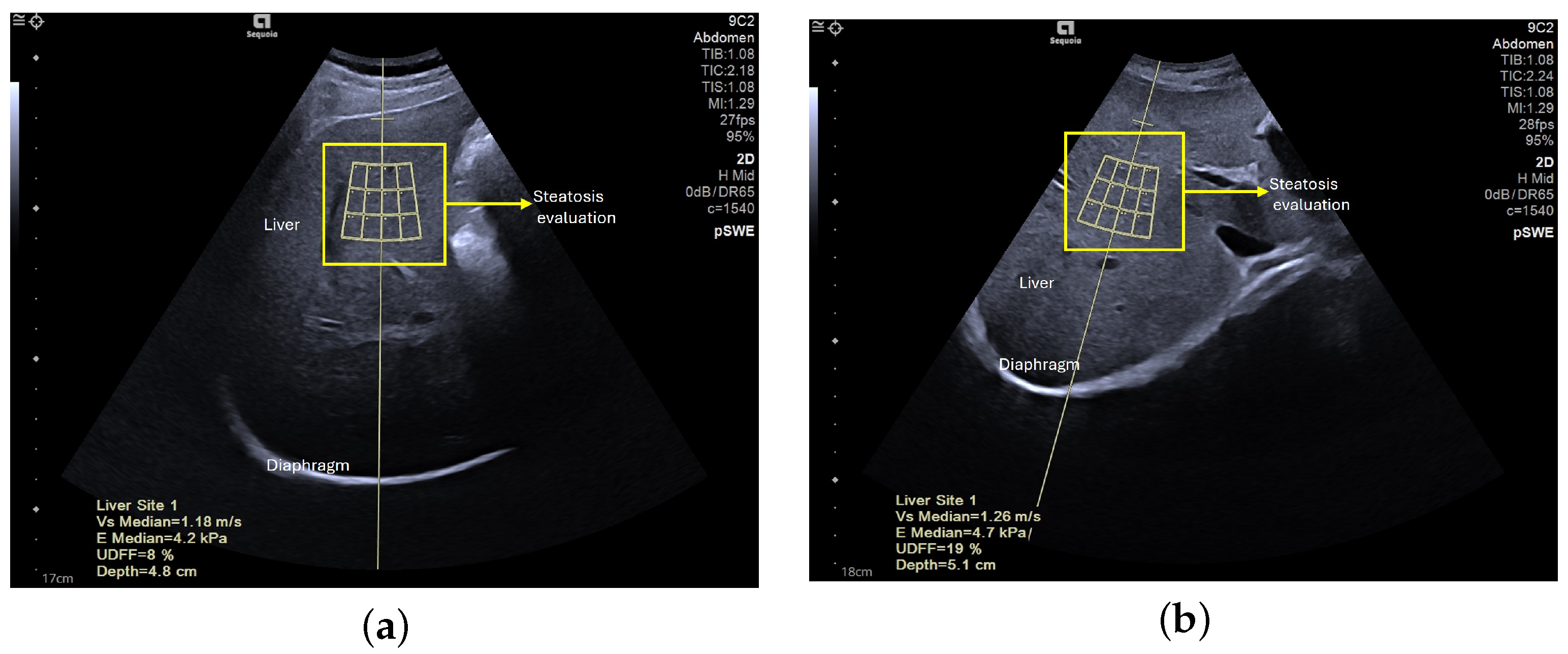 Sensors 24 07568 g003
