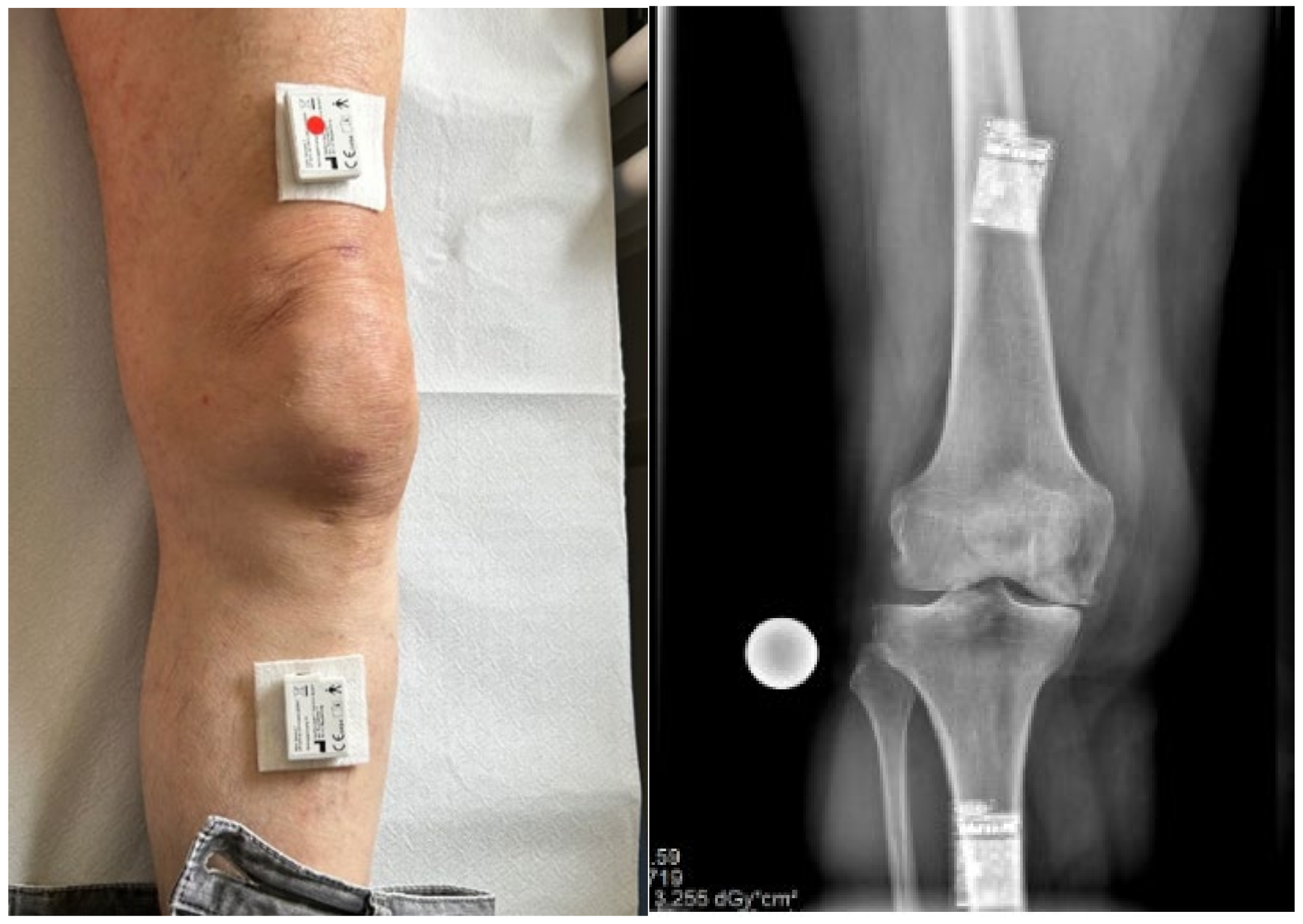 Sensors 25 00118 g001