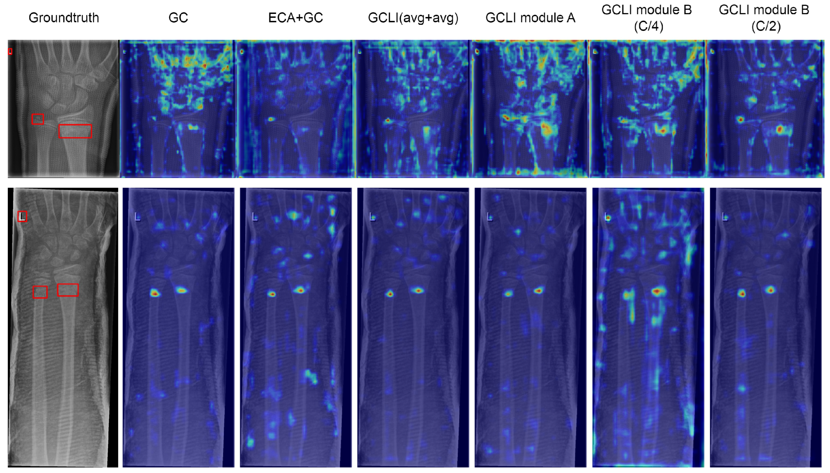 Sensors 25 00163 g011