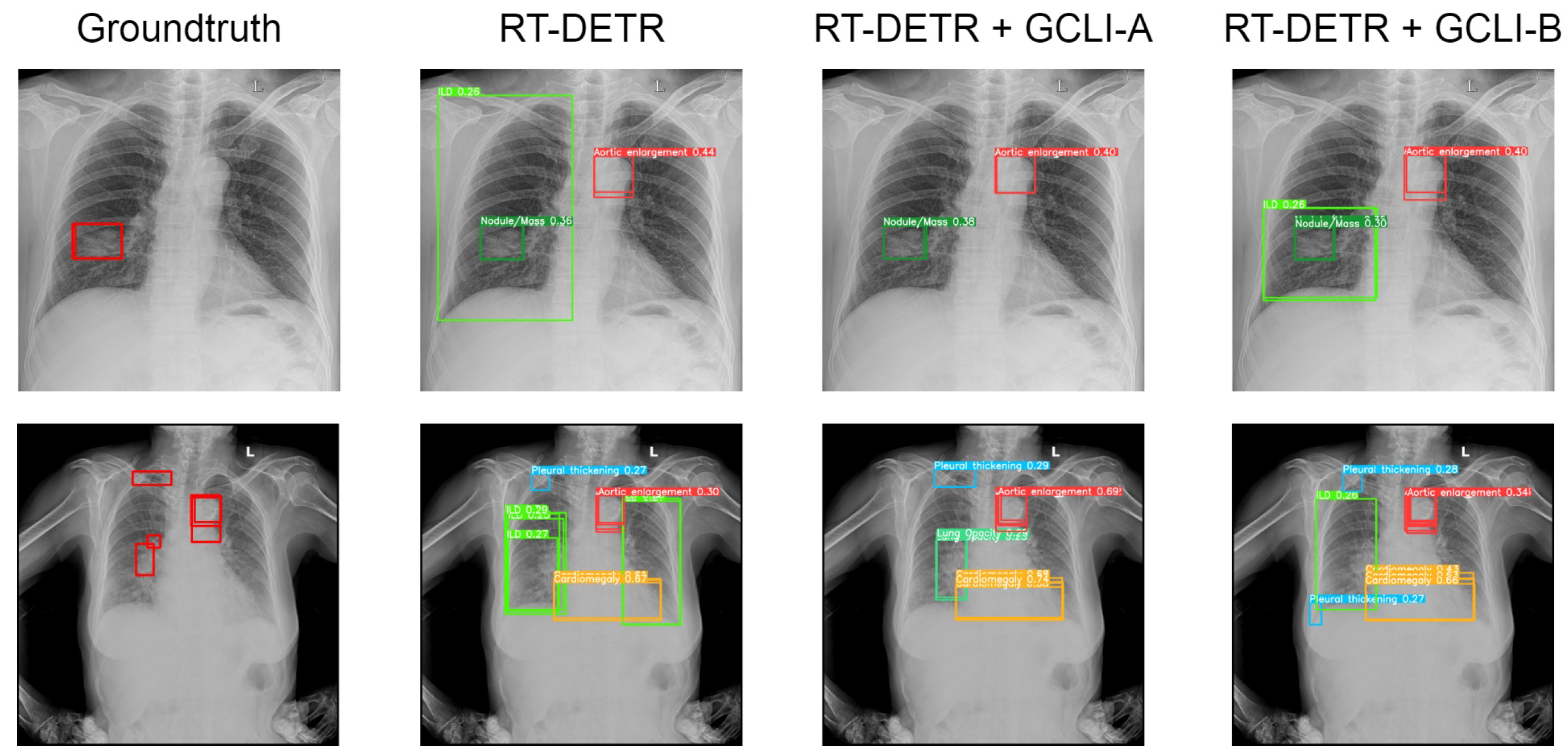 Sensors 25 00163 g014