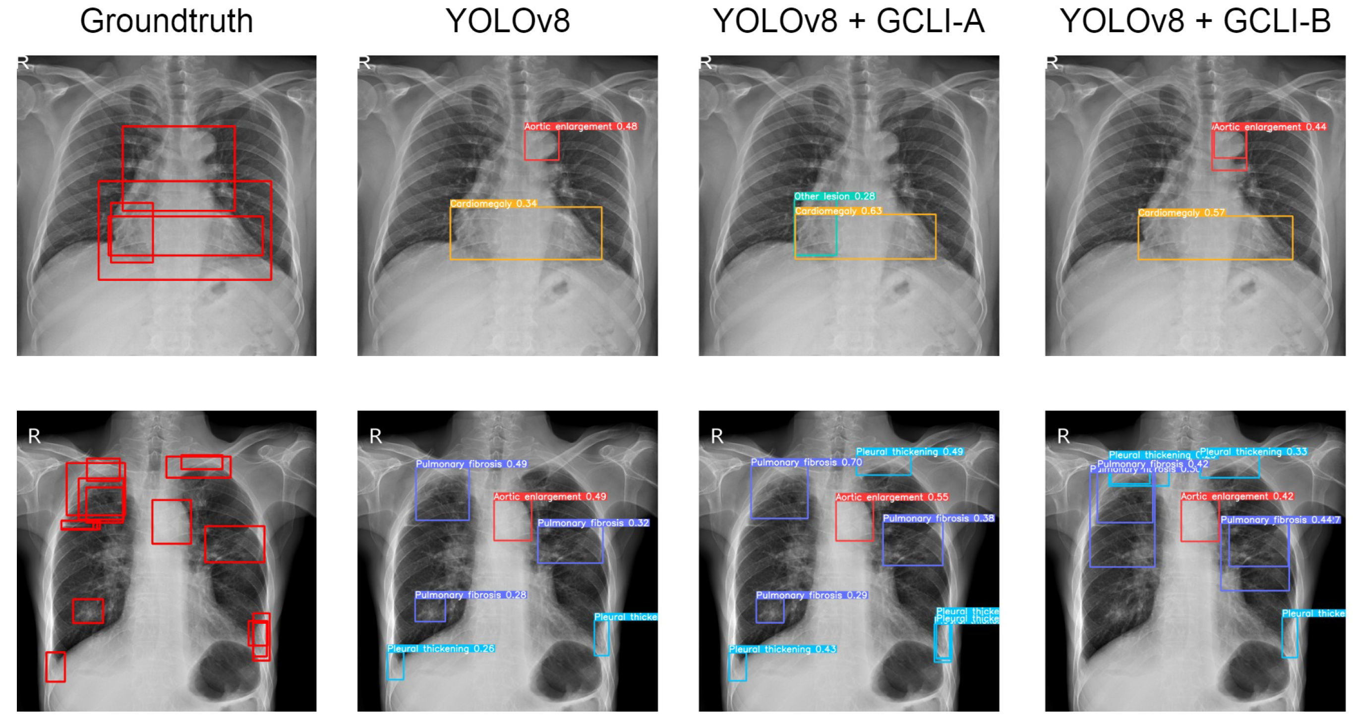 Sensors 25 00163 g015