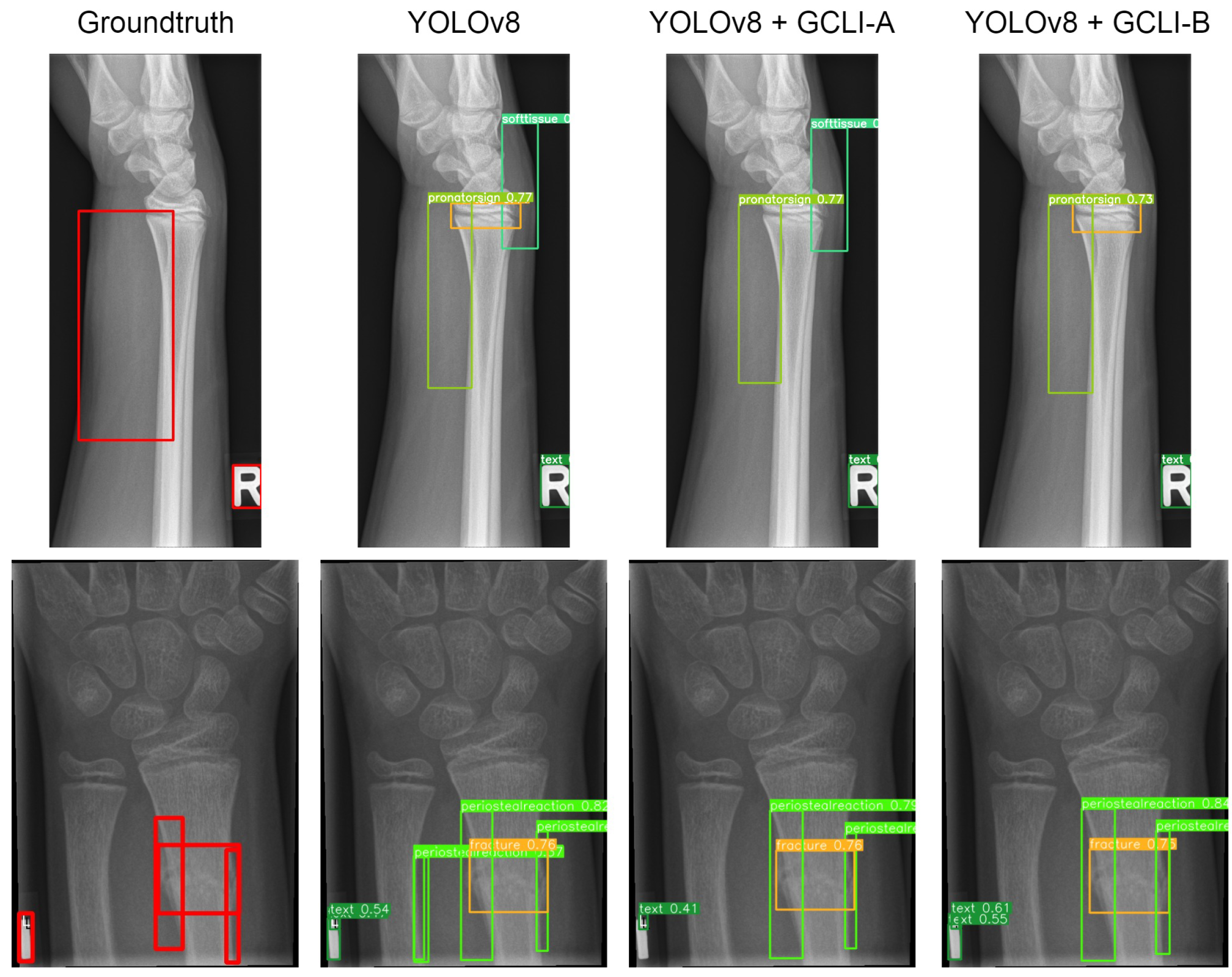 Sensors 25 00163 g017