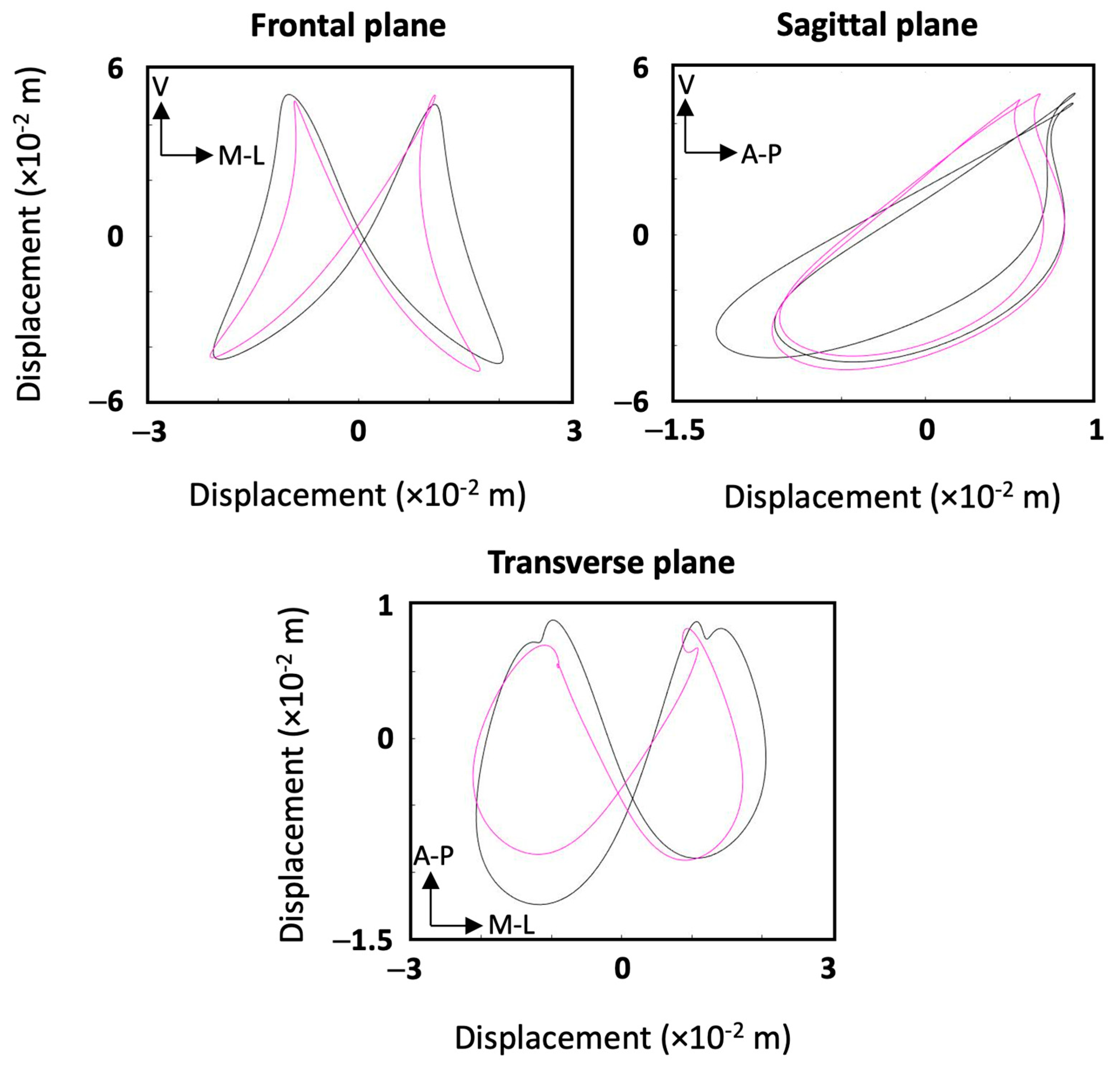 Sensors 25 00315 g006