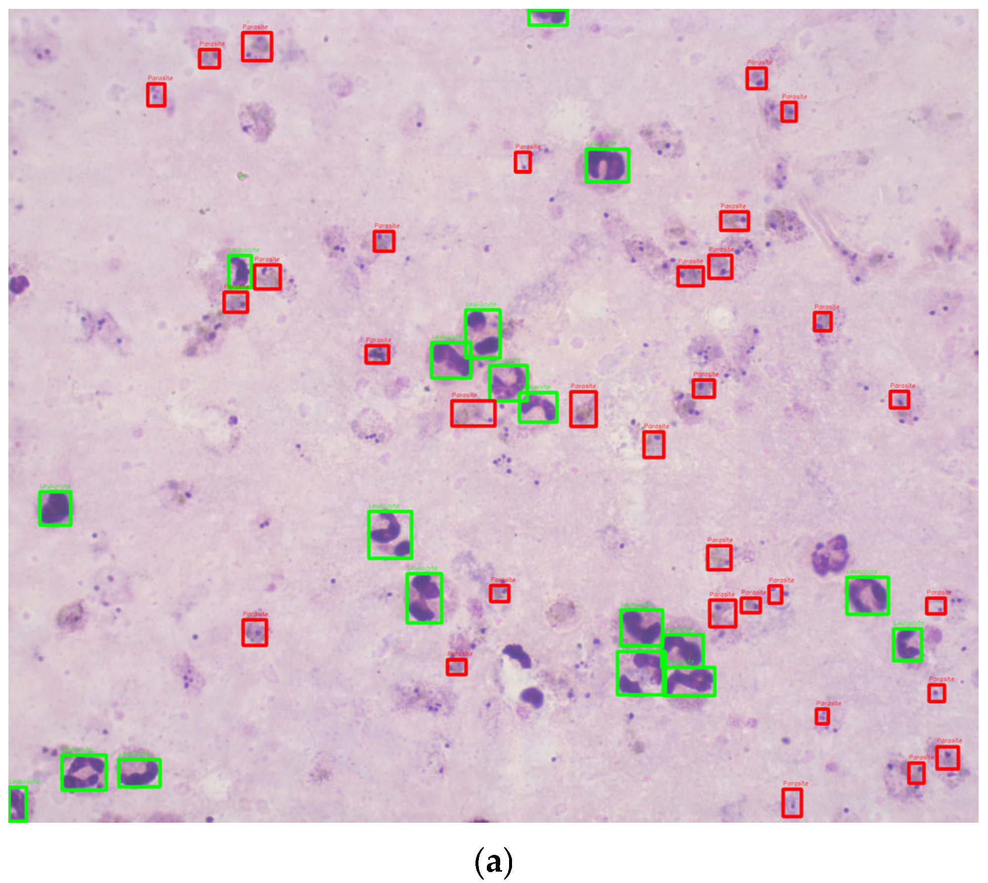 Sensors 25 00390 g002a