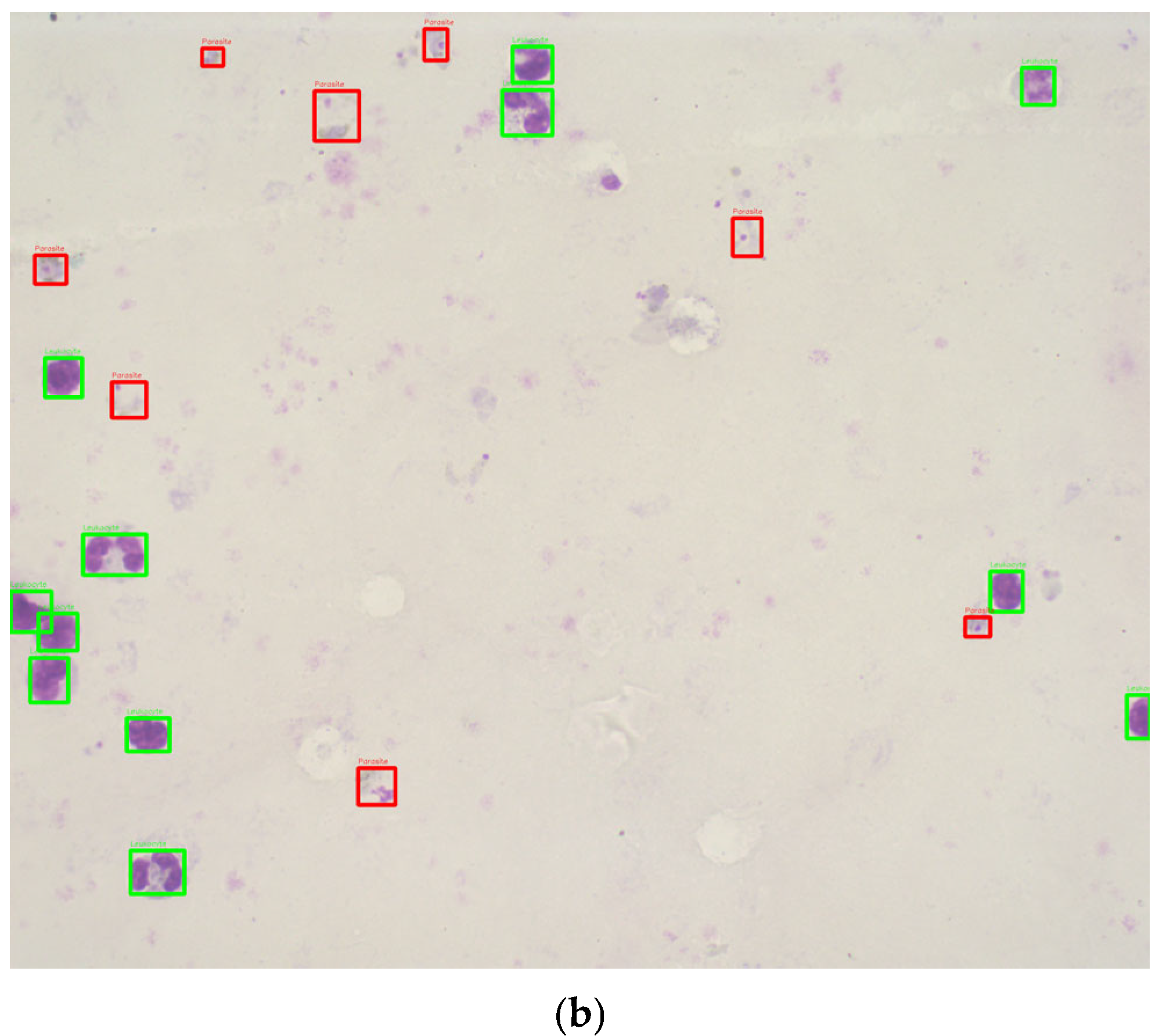 Sensors 25 00390 g002b