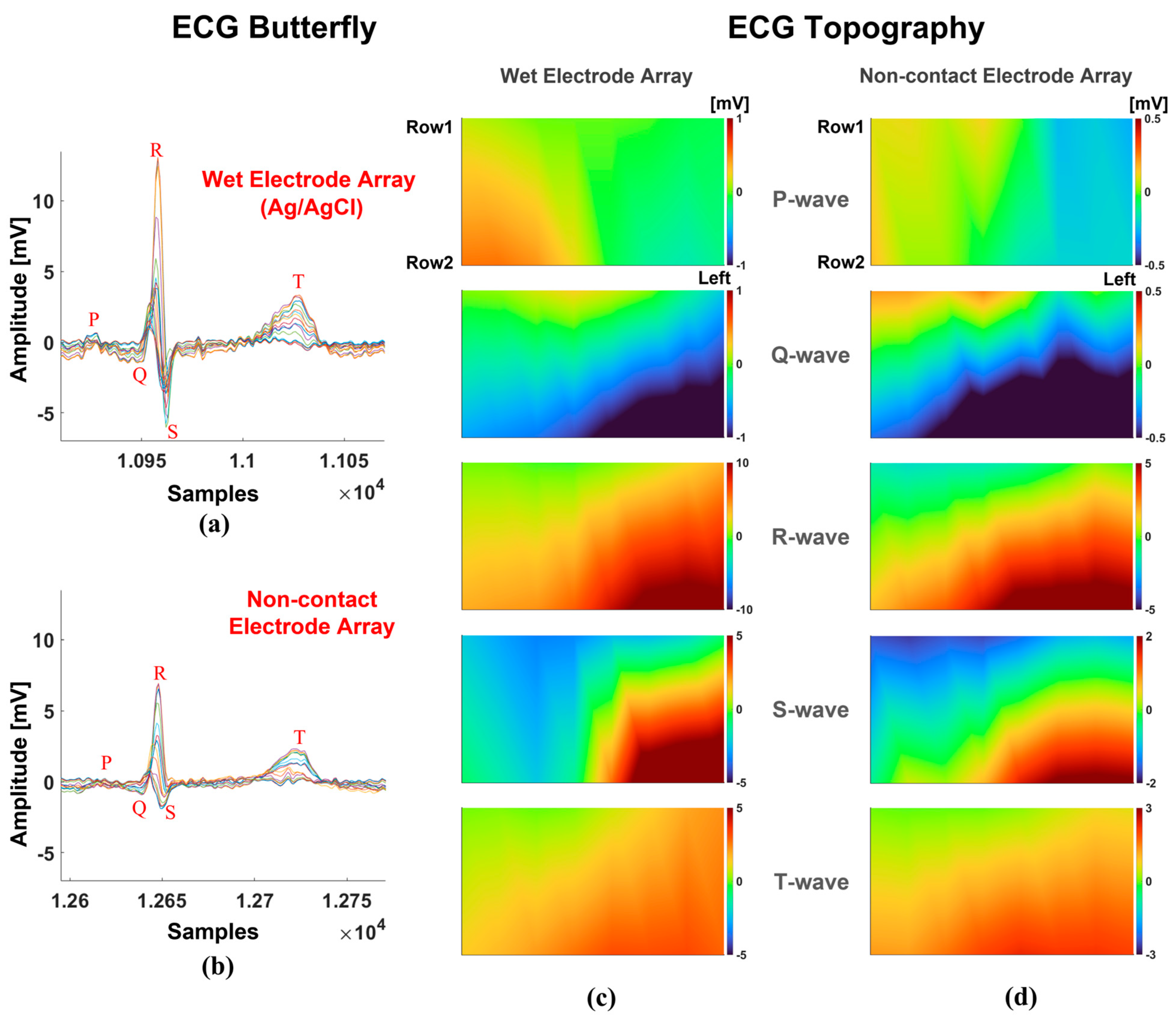 Sensors 25 00445 g011