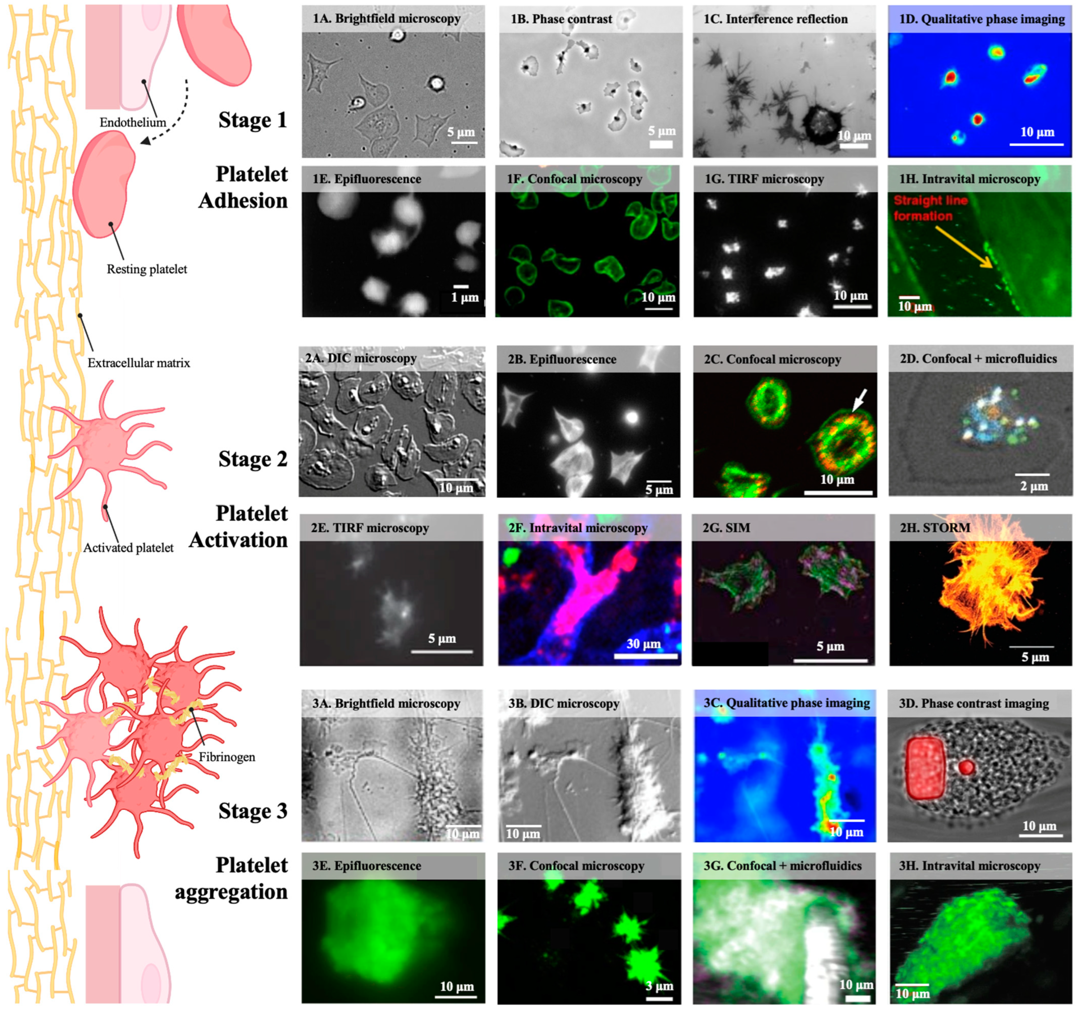 Advancing Platelet Research Through Live-Cell Imaging