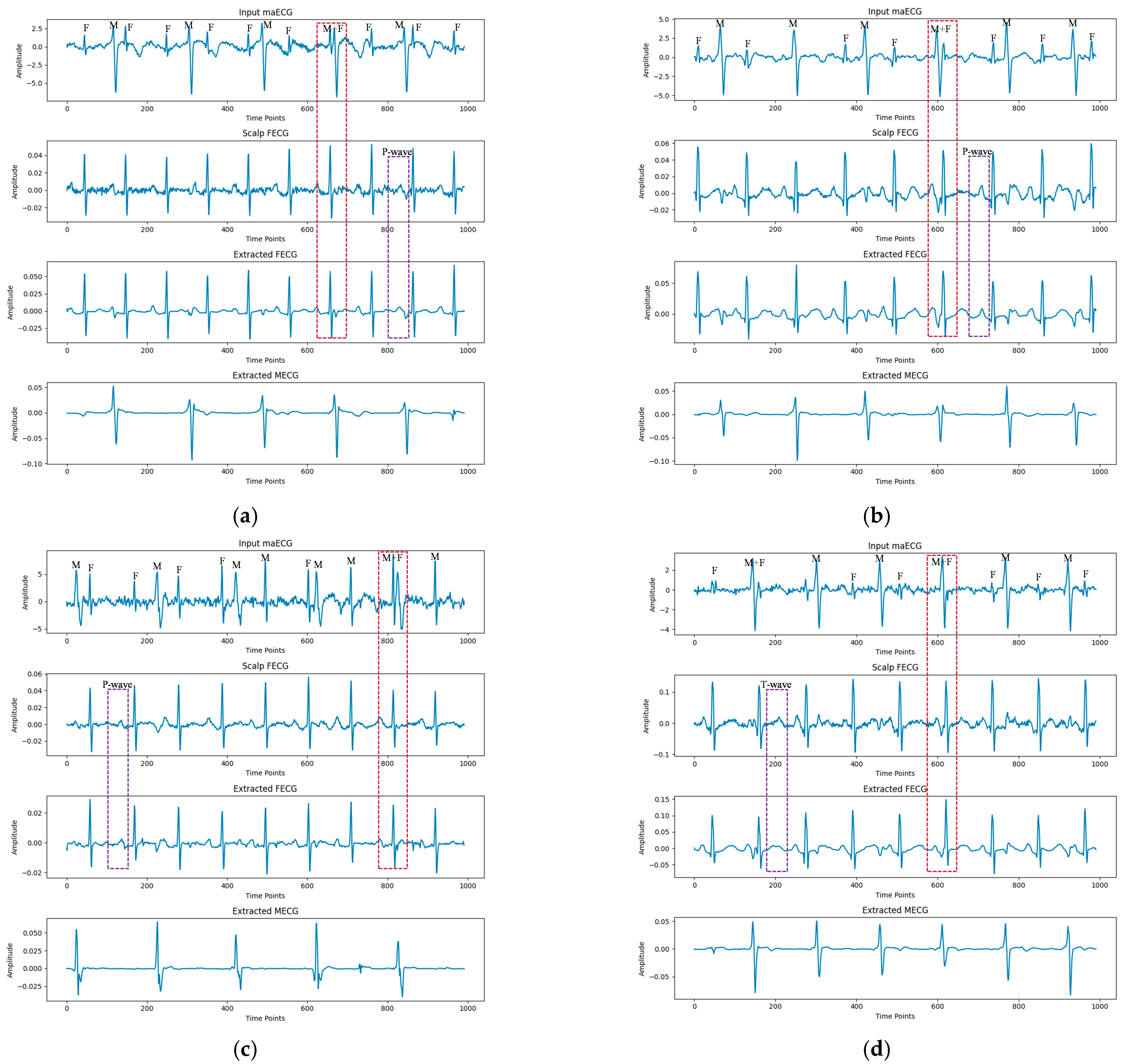 Sensors 25 00601 g006