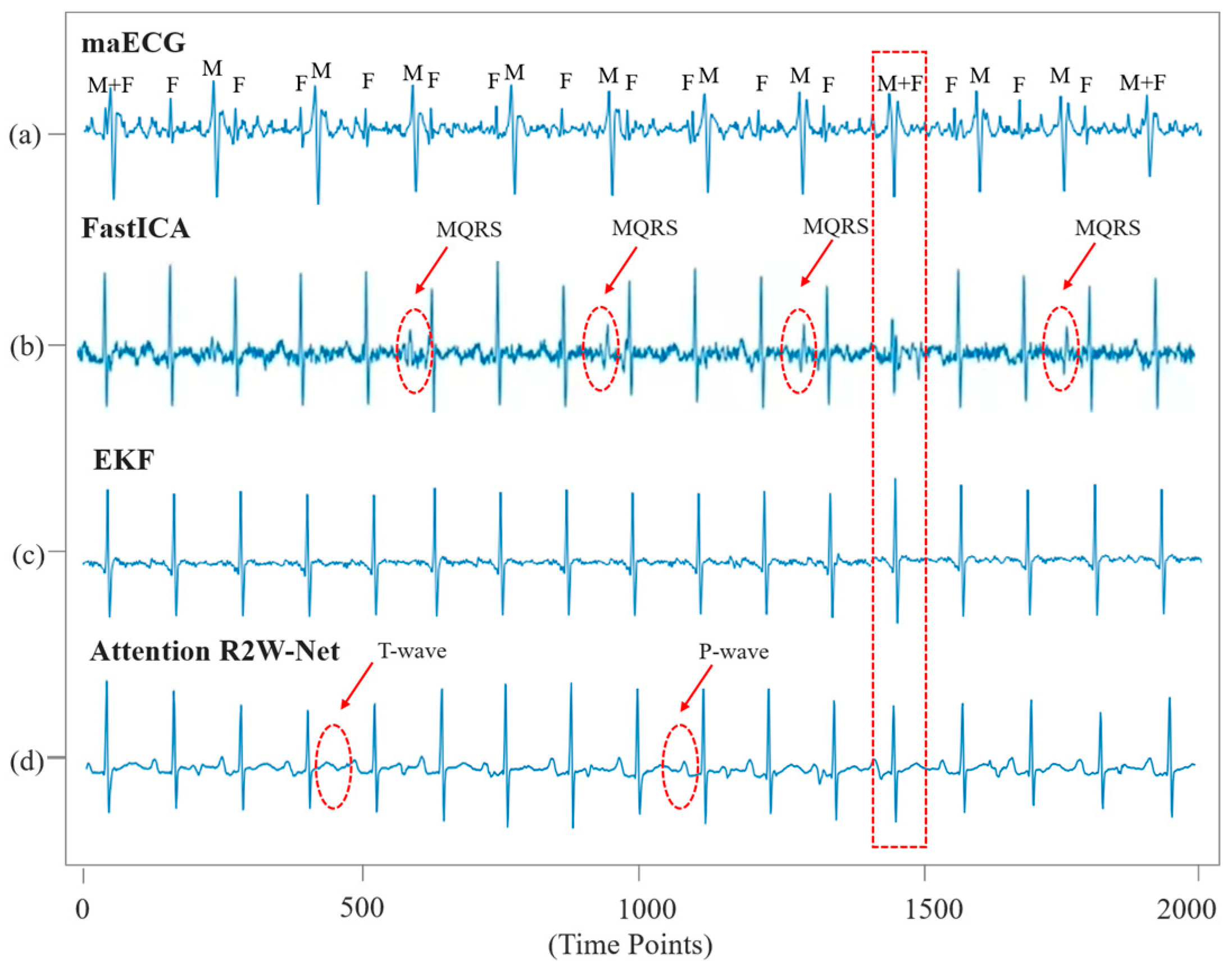 Sensors 25 00601 g011