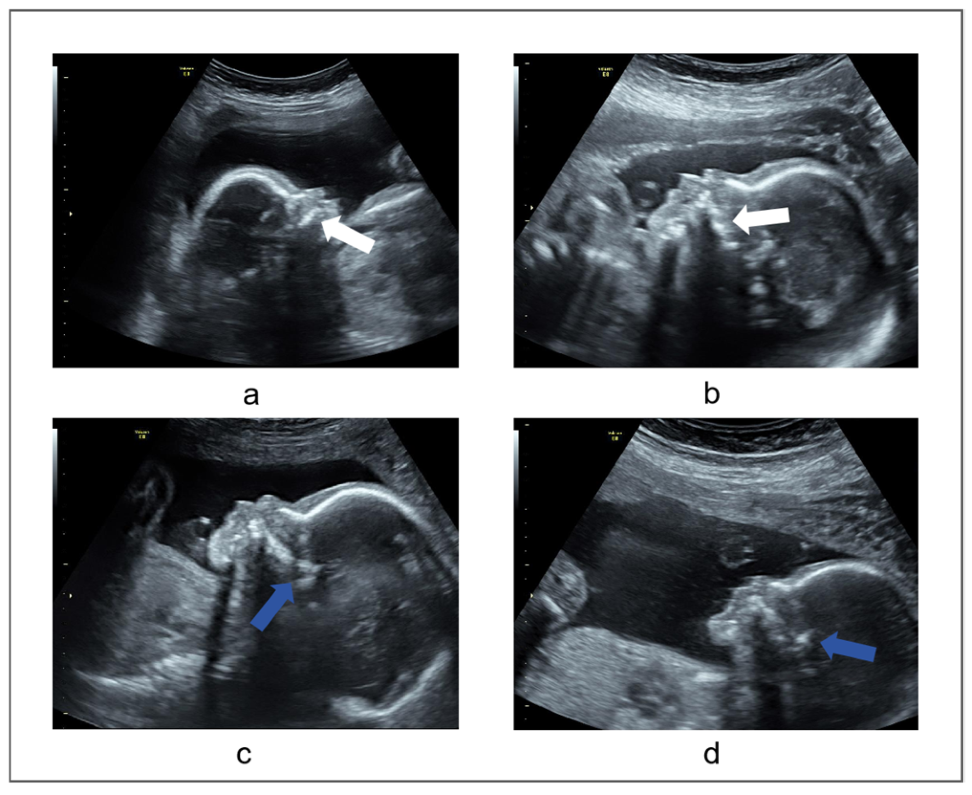 Sensors 25 00633 g002