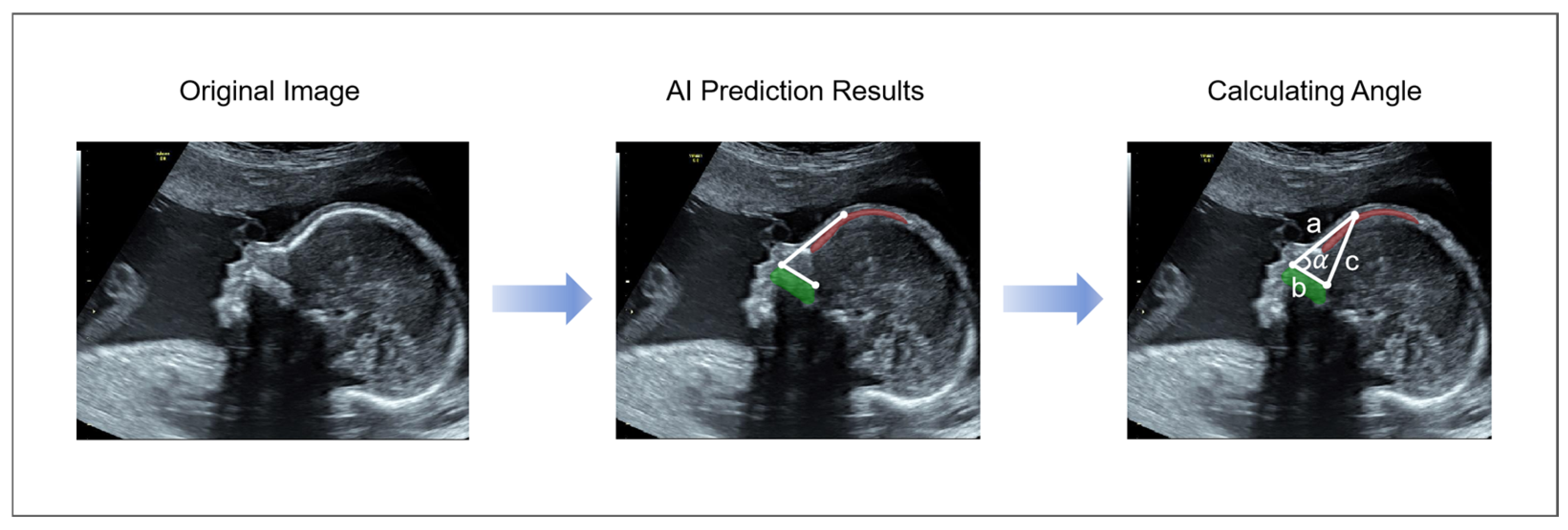 Sensors 25 00633 g007