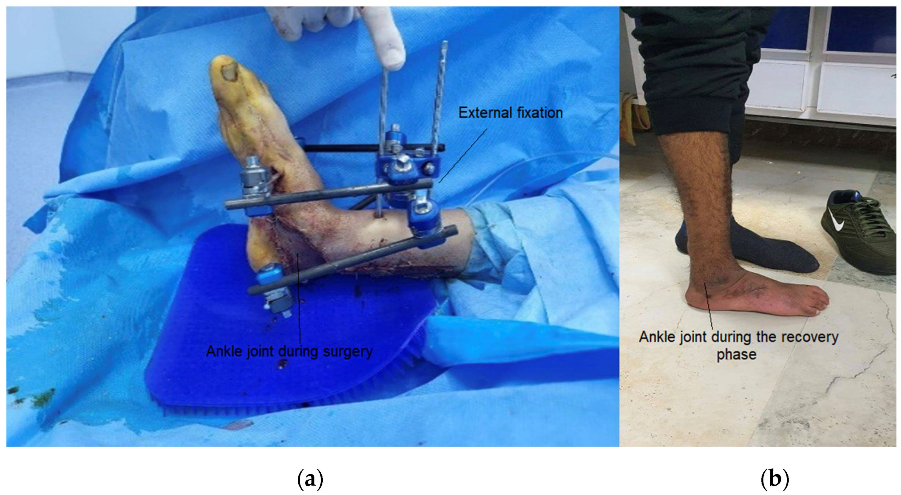 Sensors 25 00832 g001
