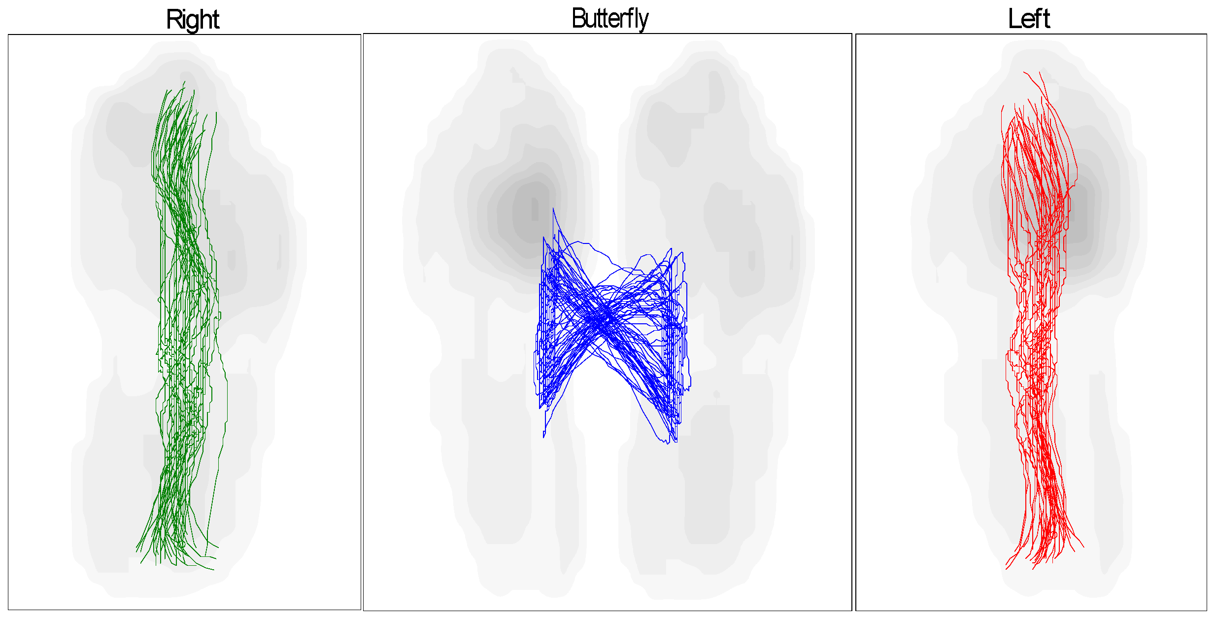 Sensors 25 00832 g017