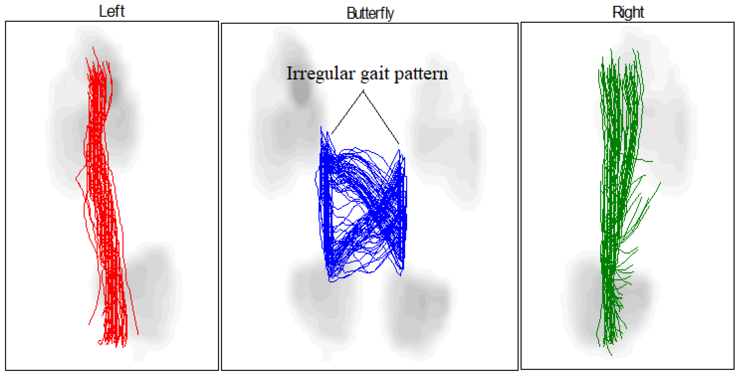 Sensors 25 00832 g018