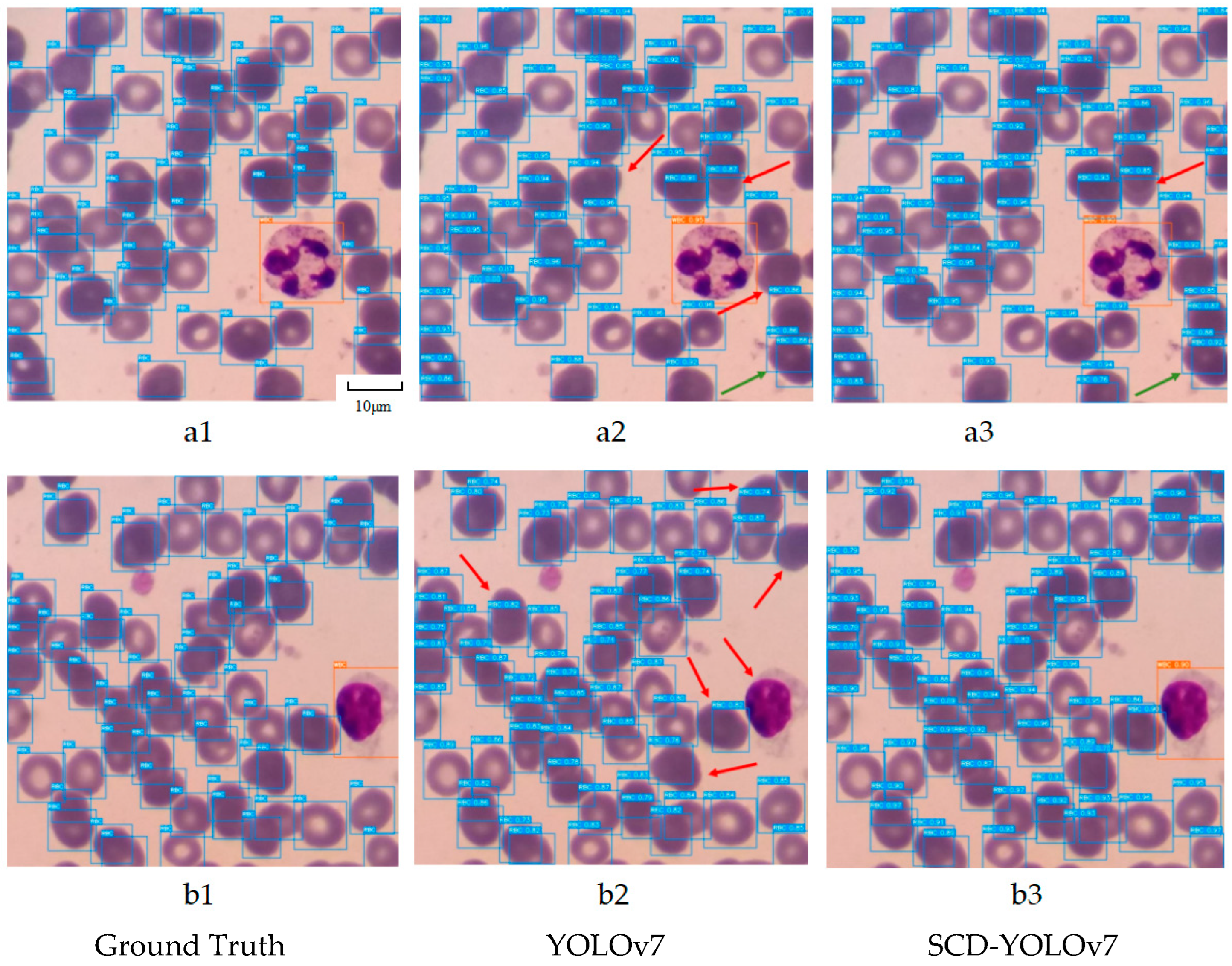 Sensors 25 00882 g011