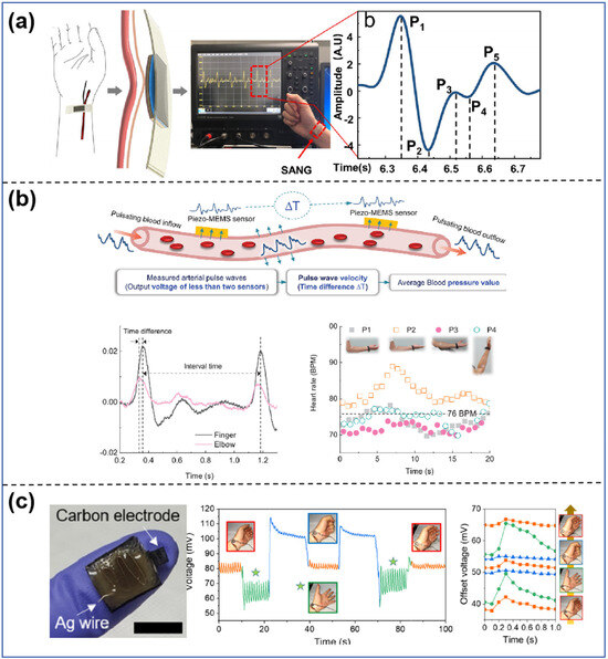 The SAMHD1-MX2 axis restricts HIV-1 infection at postviral DNA synthesis |  mBio
