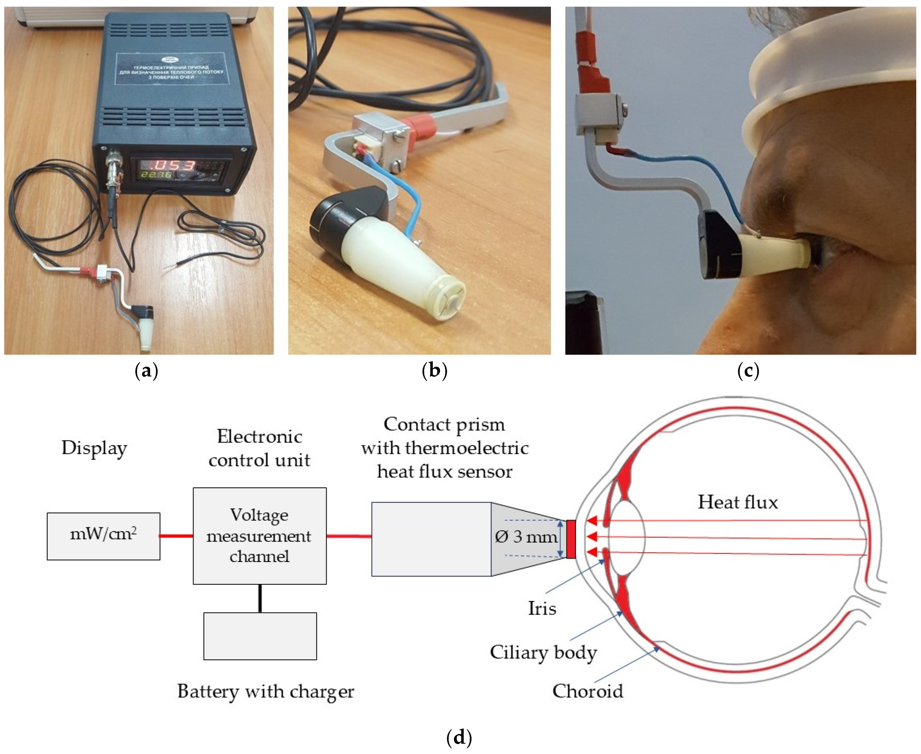 Sensors 25 00999 g004