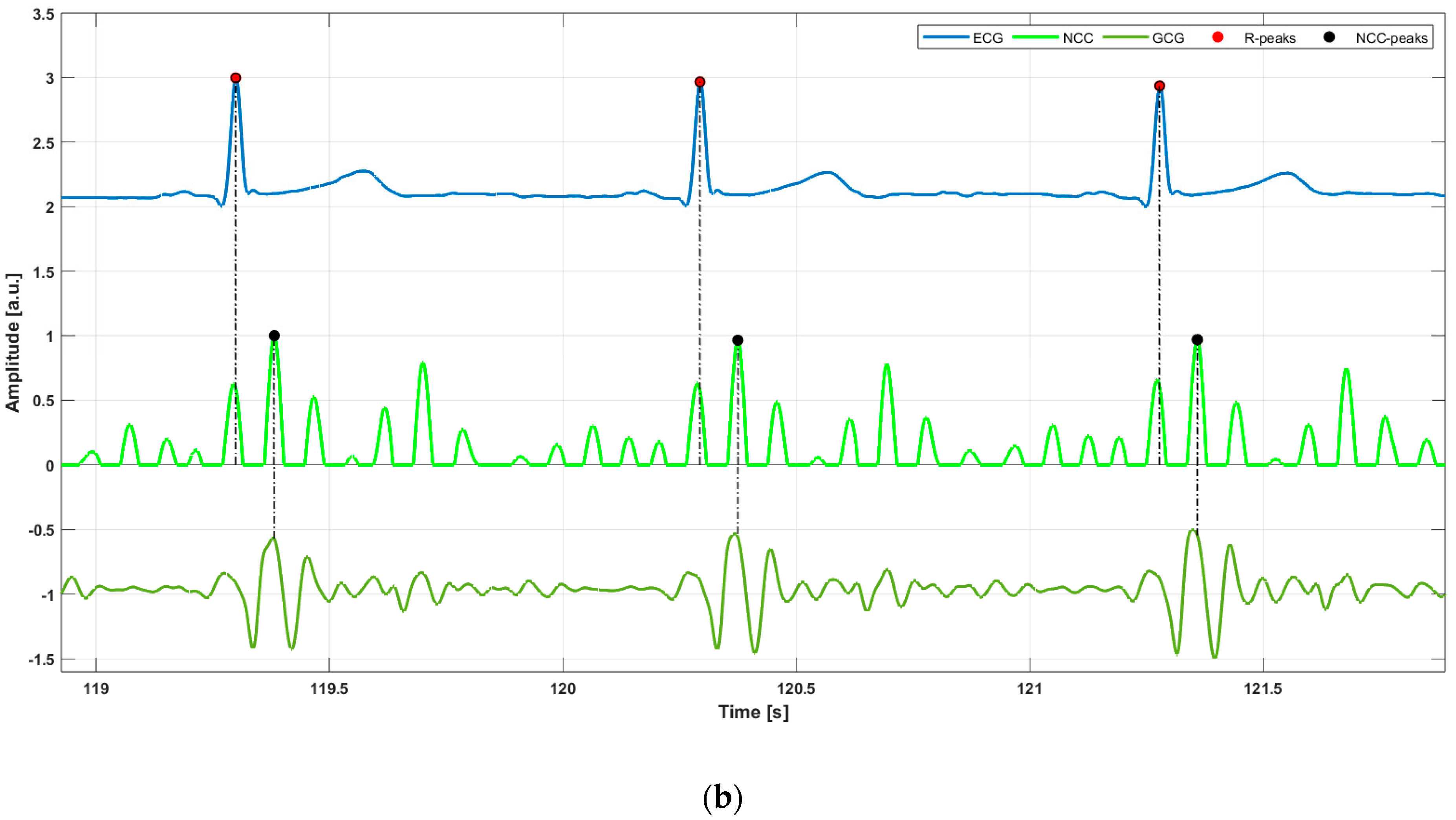 Sensors 25 01094 g002b