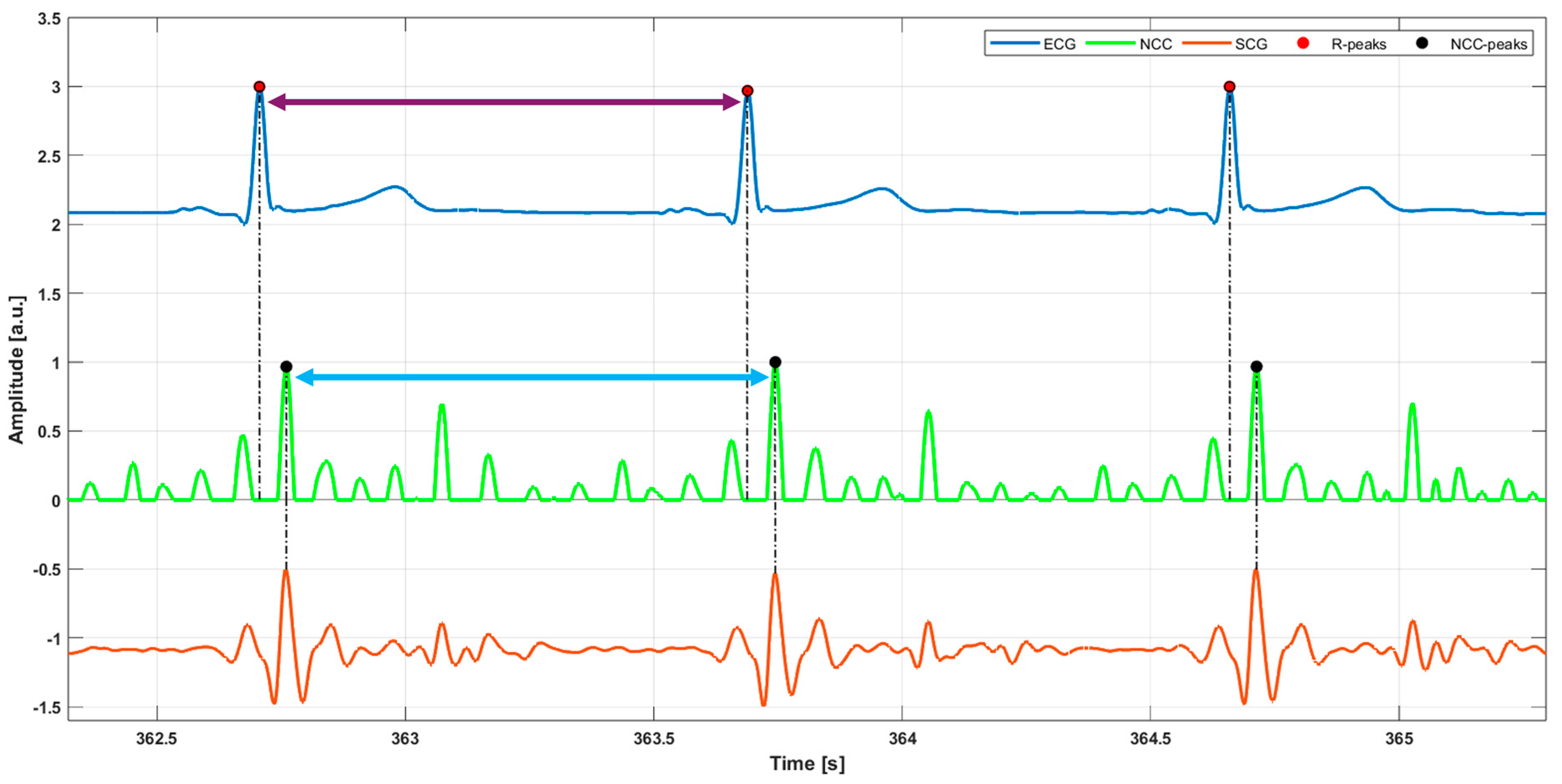 Sensors 25 01094 g003