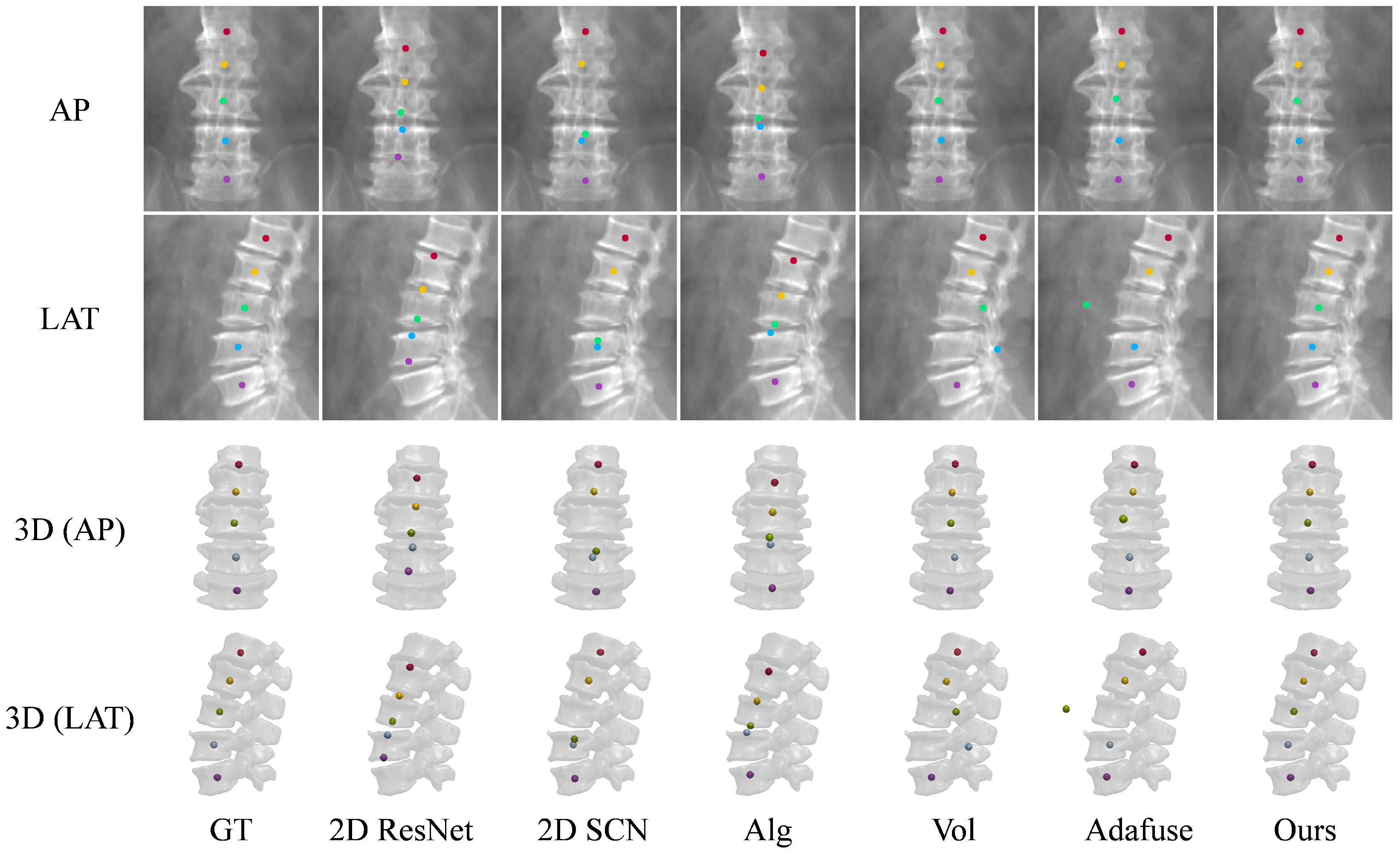 Sensors 25 01123 g005