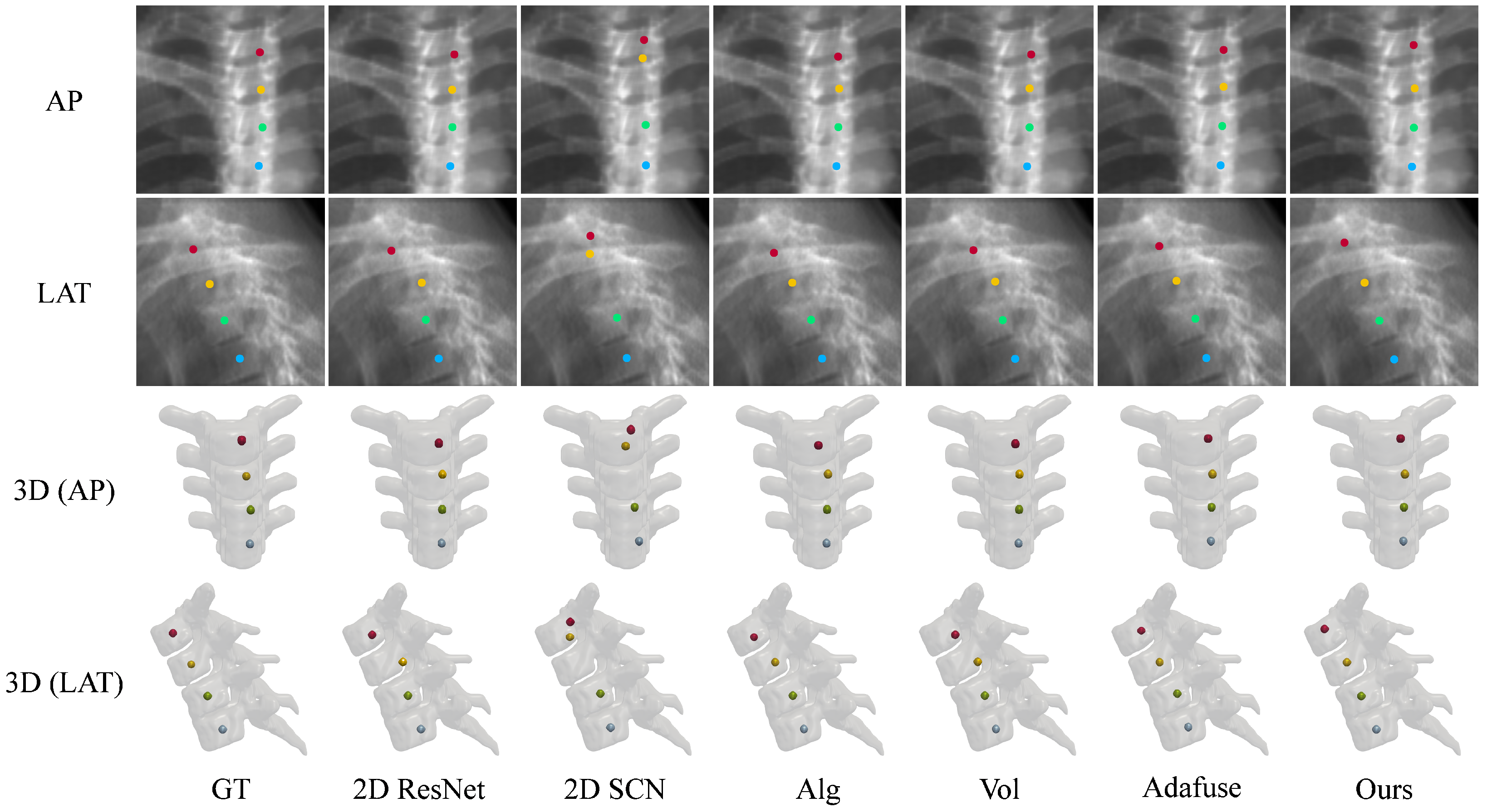 Sensors 25 01123 g006
