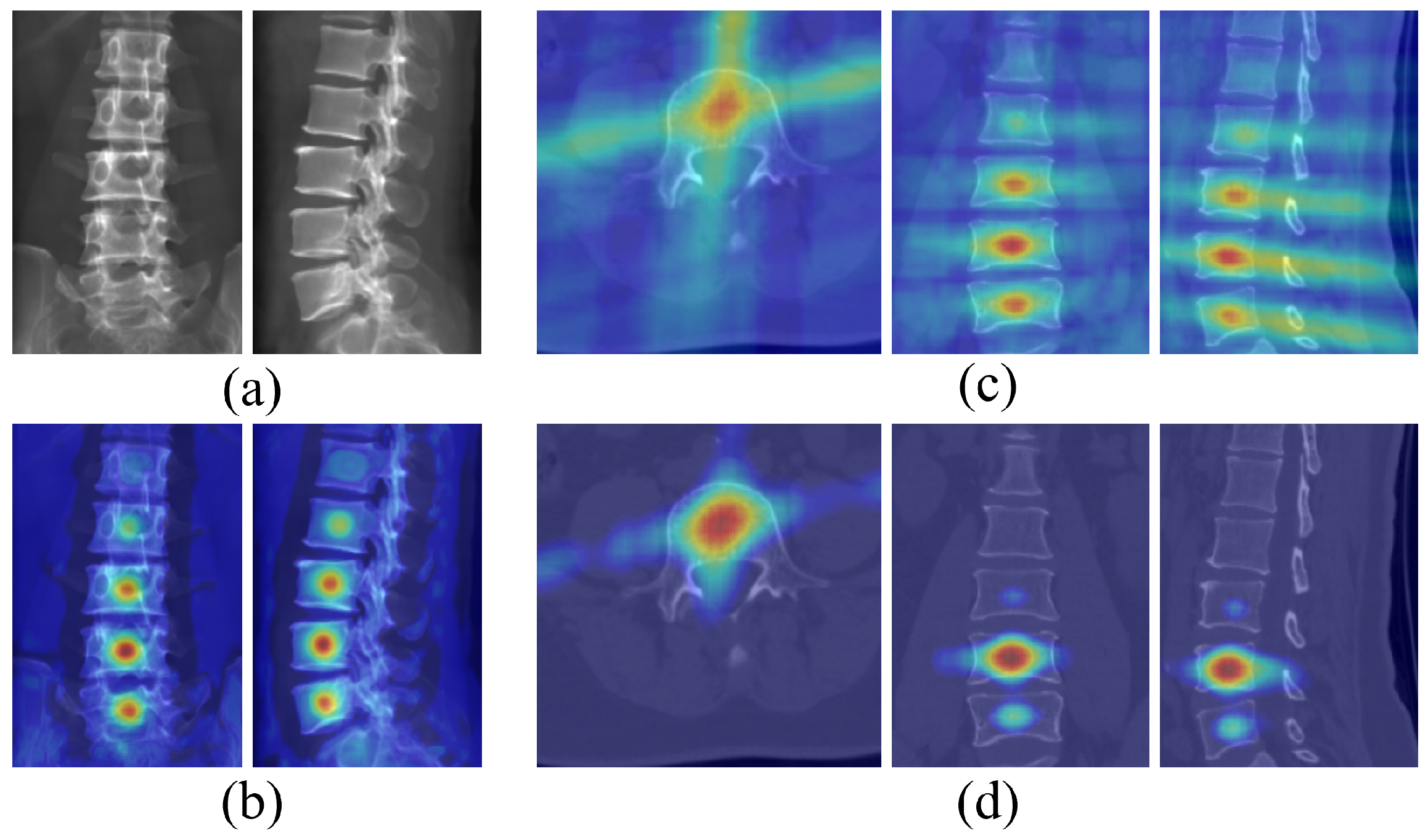 Sensors 25 01123 g008