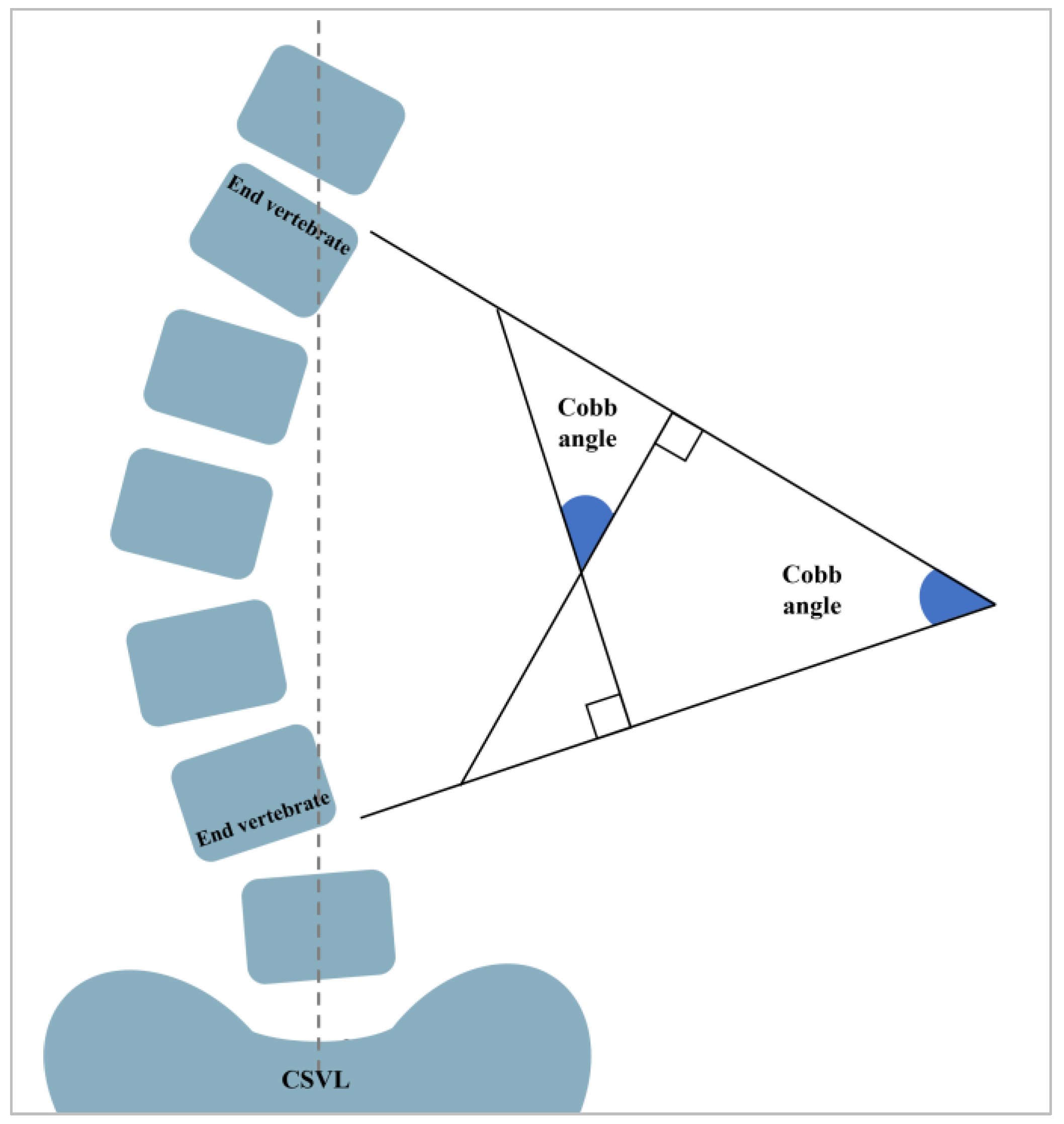 Sensors 25 01284 g007