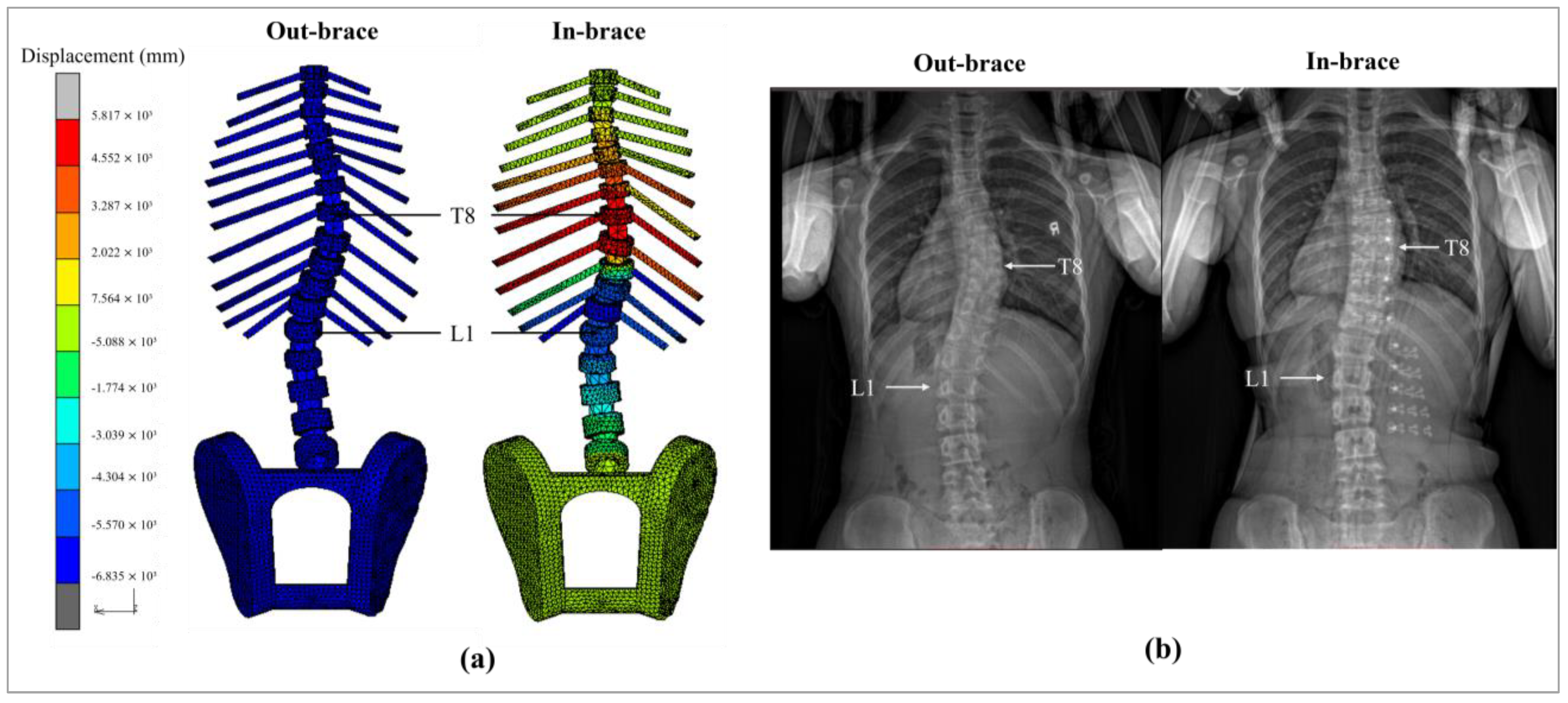 Sensors 25 01284 g010
