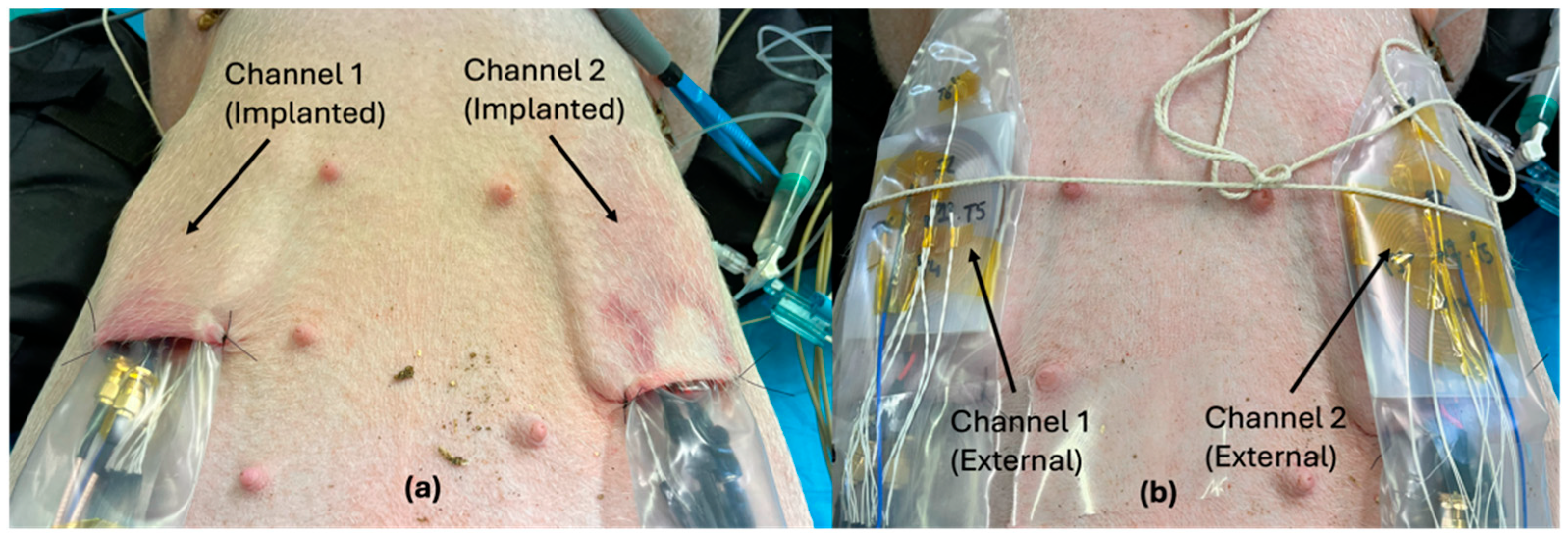Sensors 25 01311 g005