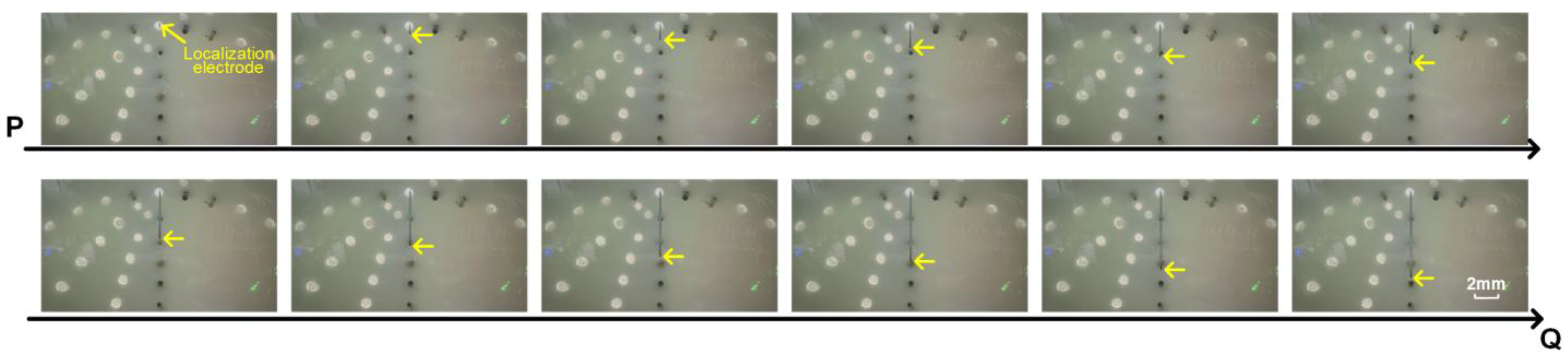 Sensors 25 01378 g008