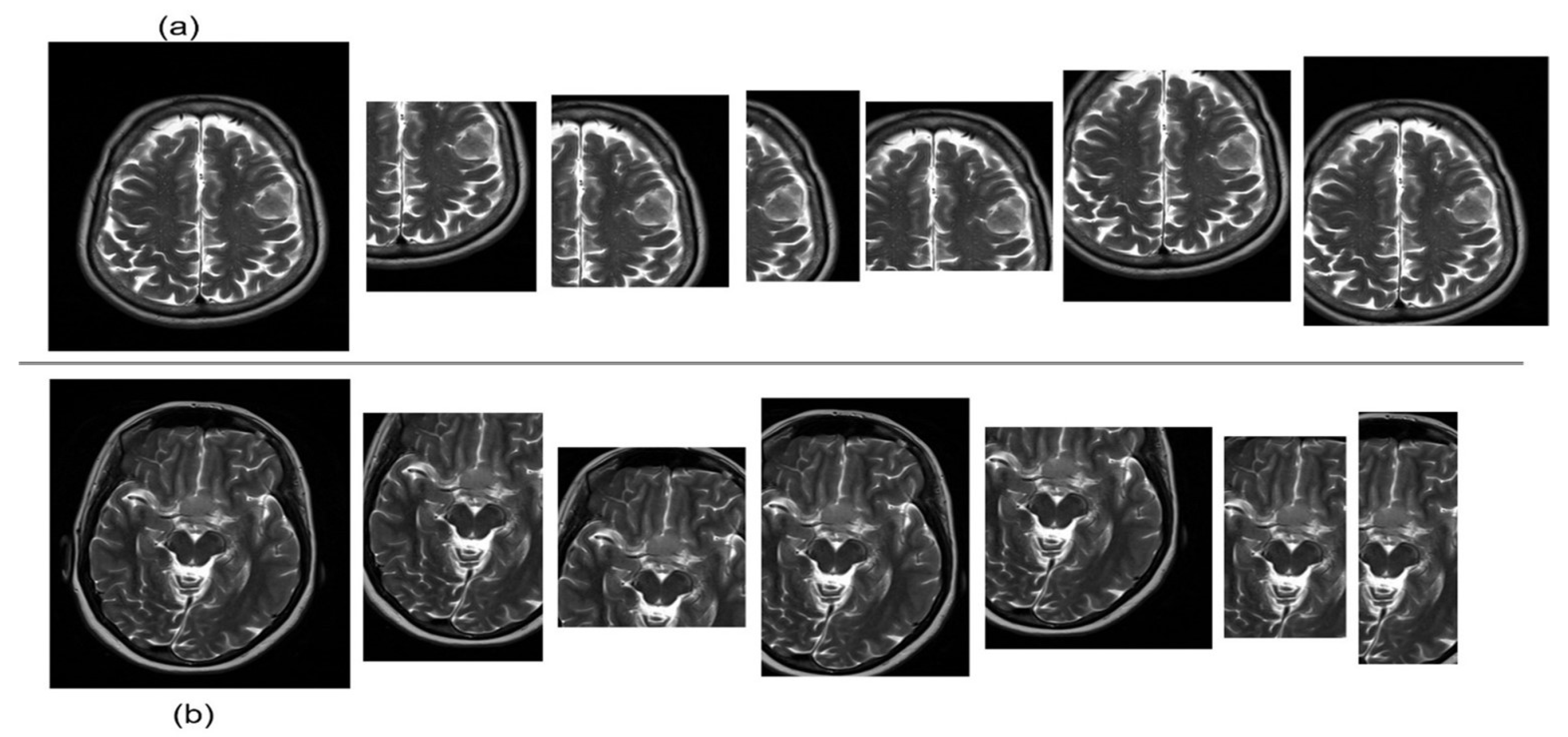 Sensors 25 01397 g003