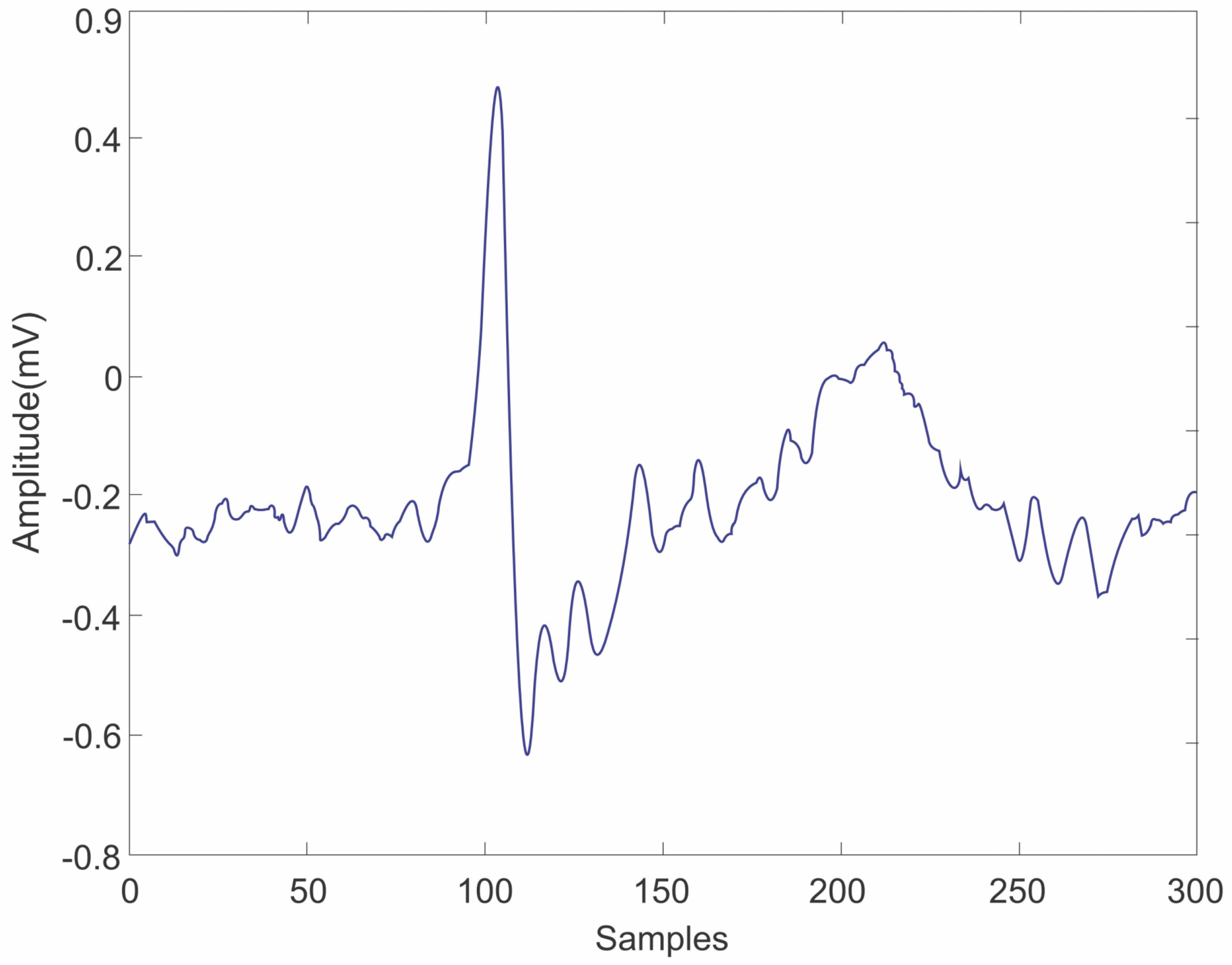 Sensors 25 01400 g004