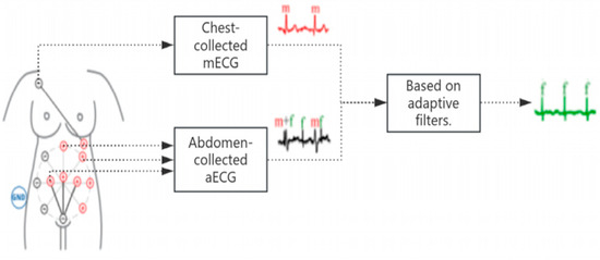 Review of Non-Invasive Fetal Electrocardiography Monitoring