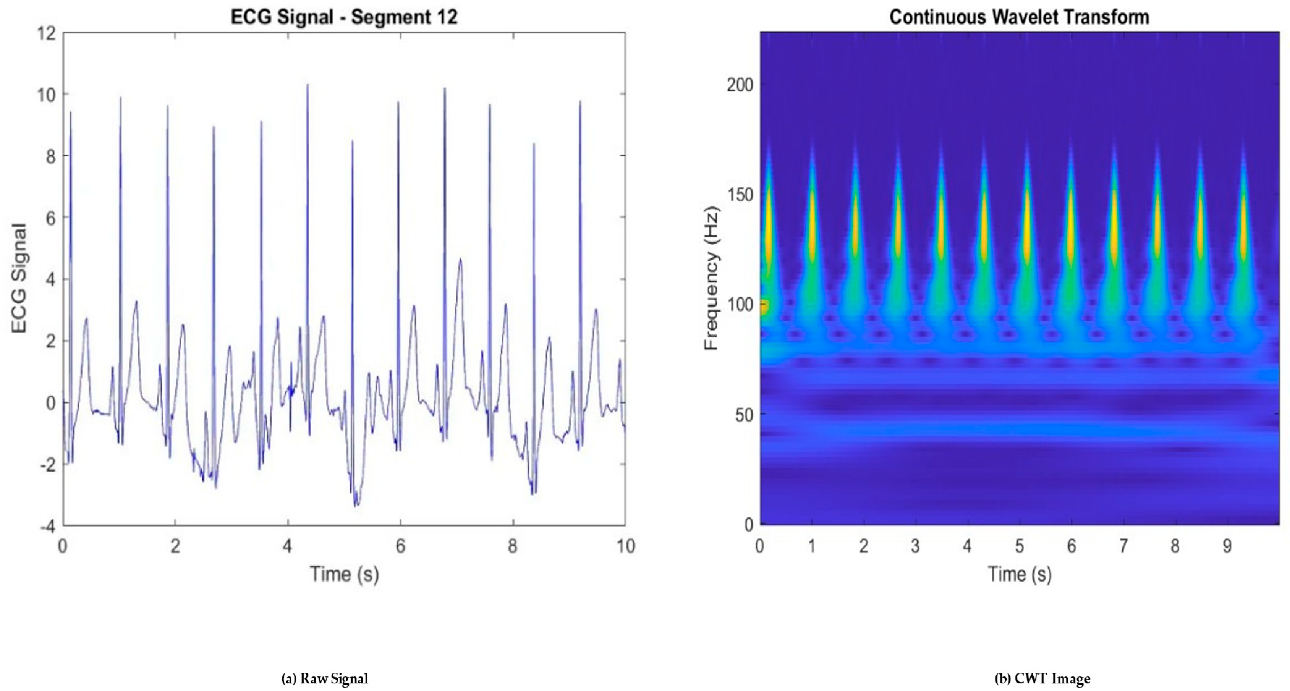 Sensors 25 01436 g003